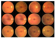 Diagnostics 13 00342 i004 Diagnostics 13 00342 i004