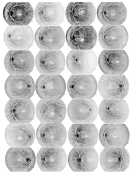 Diagnostics 13 00342 i010 Diagnostics 13 00342 i010