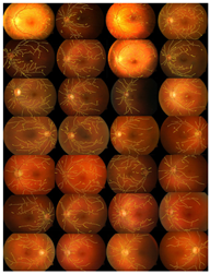 Diagnostics 13 00342 i012 Diagnostics 13 00342 i012