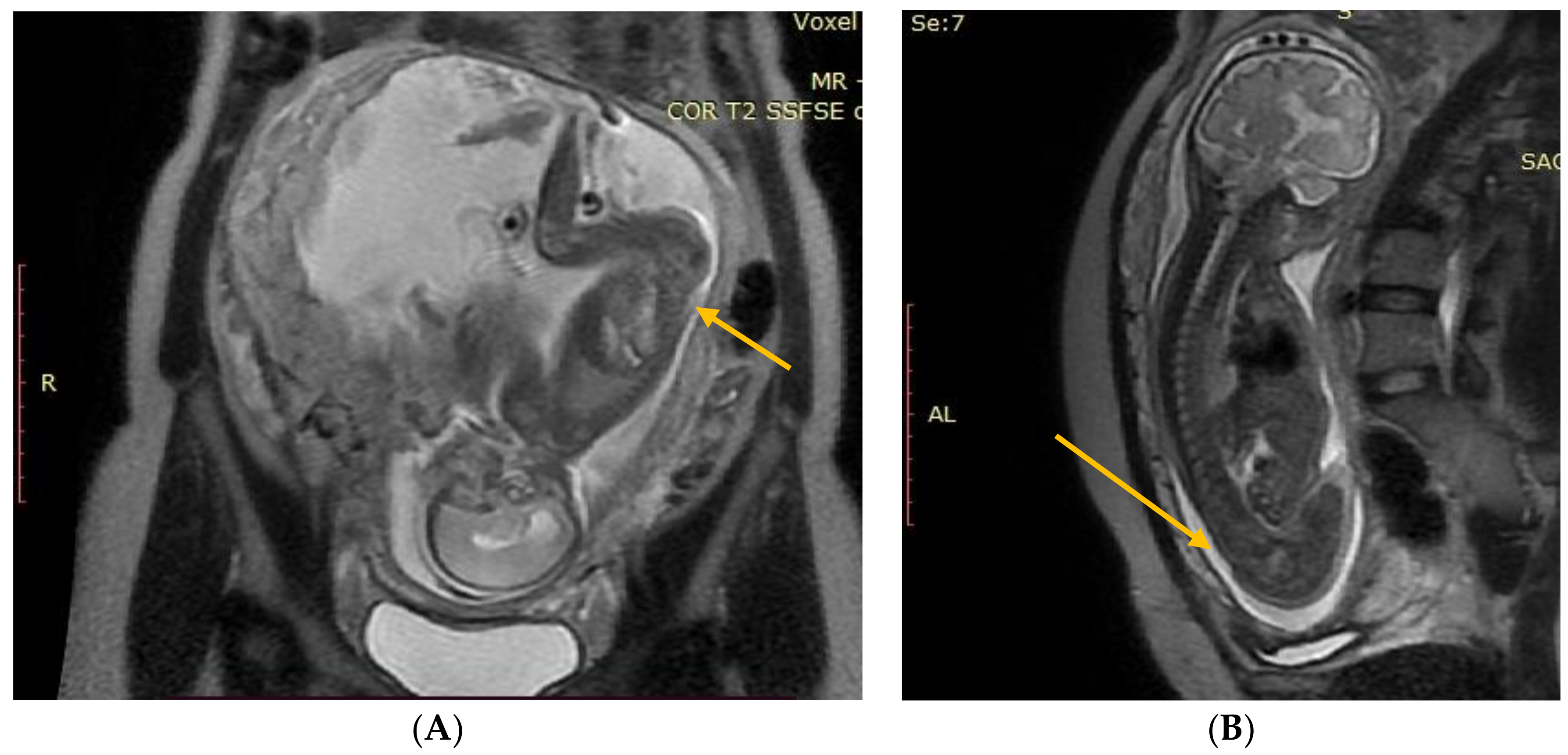 Diagnostics 13 00343 g001