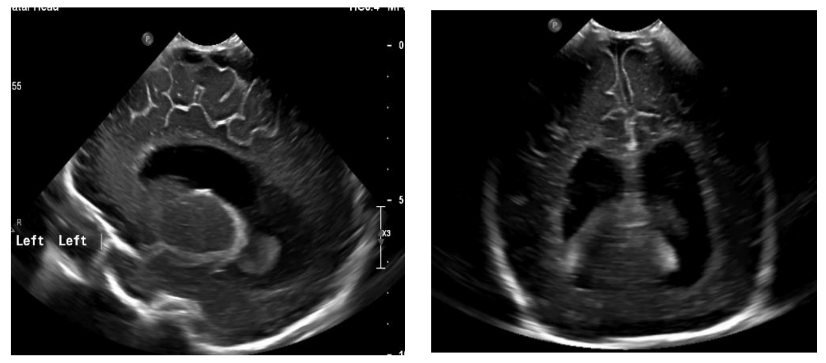 Diagnostics 13 00343 g004