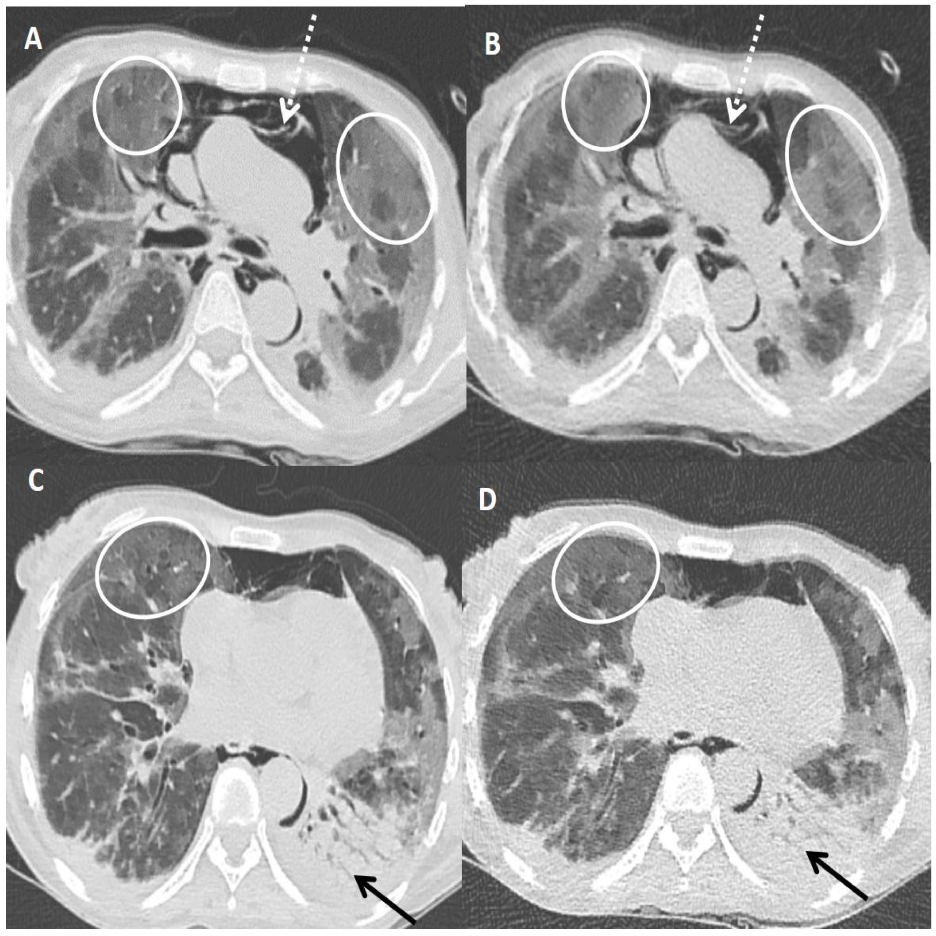 Diagnostics 13 00351 g003 Diagnostics 13 00351 g003