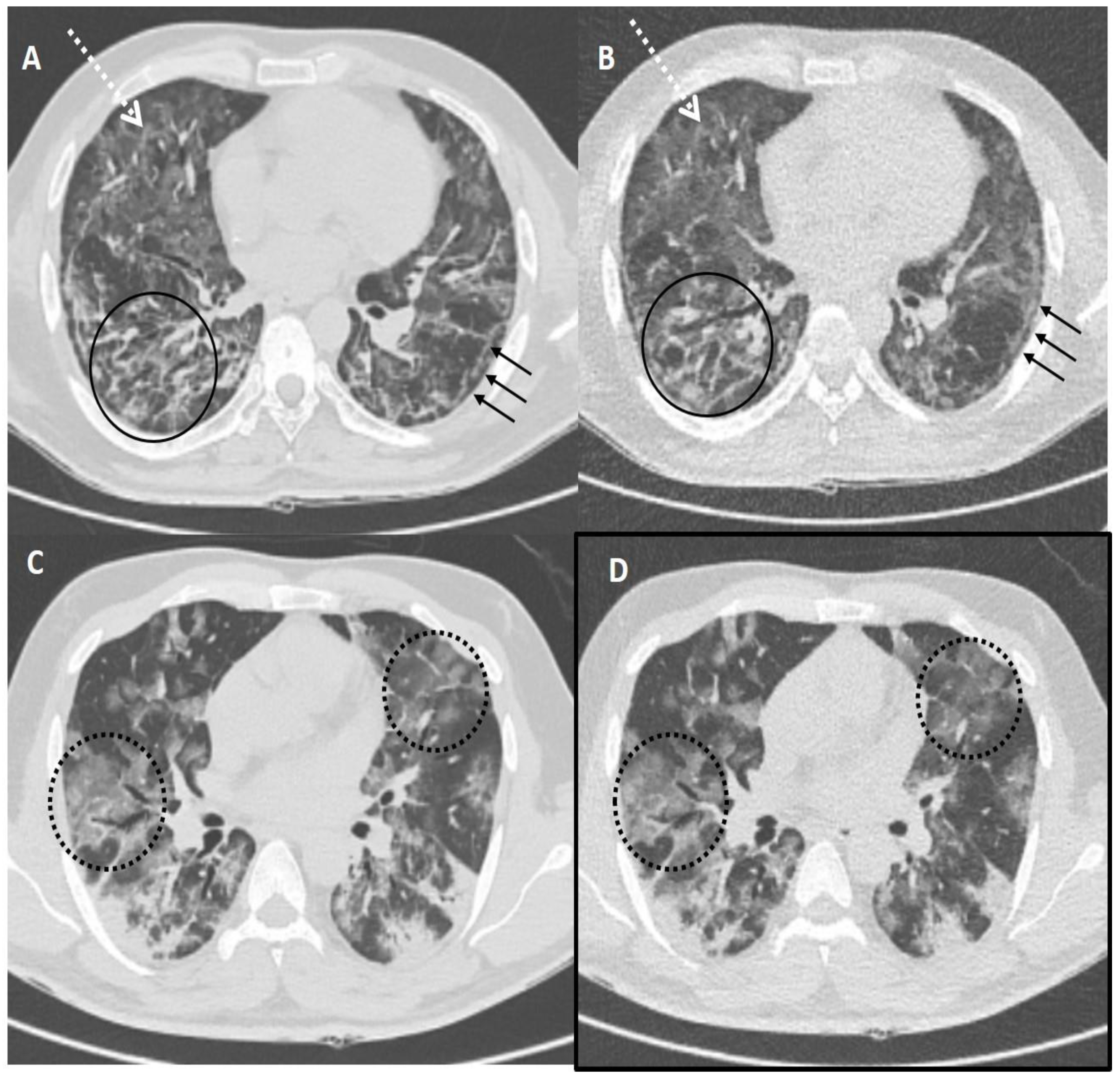 Diagnostics 13 00351 g004 Diagnostics 13 00351 g004