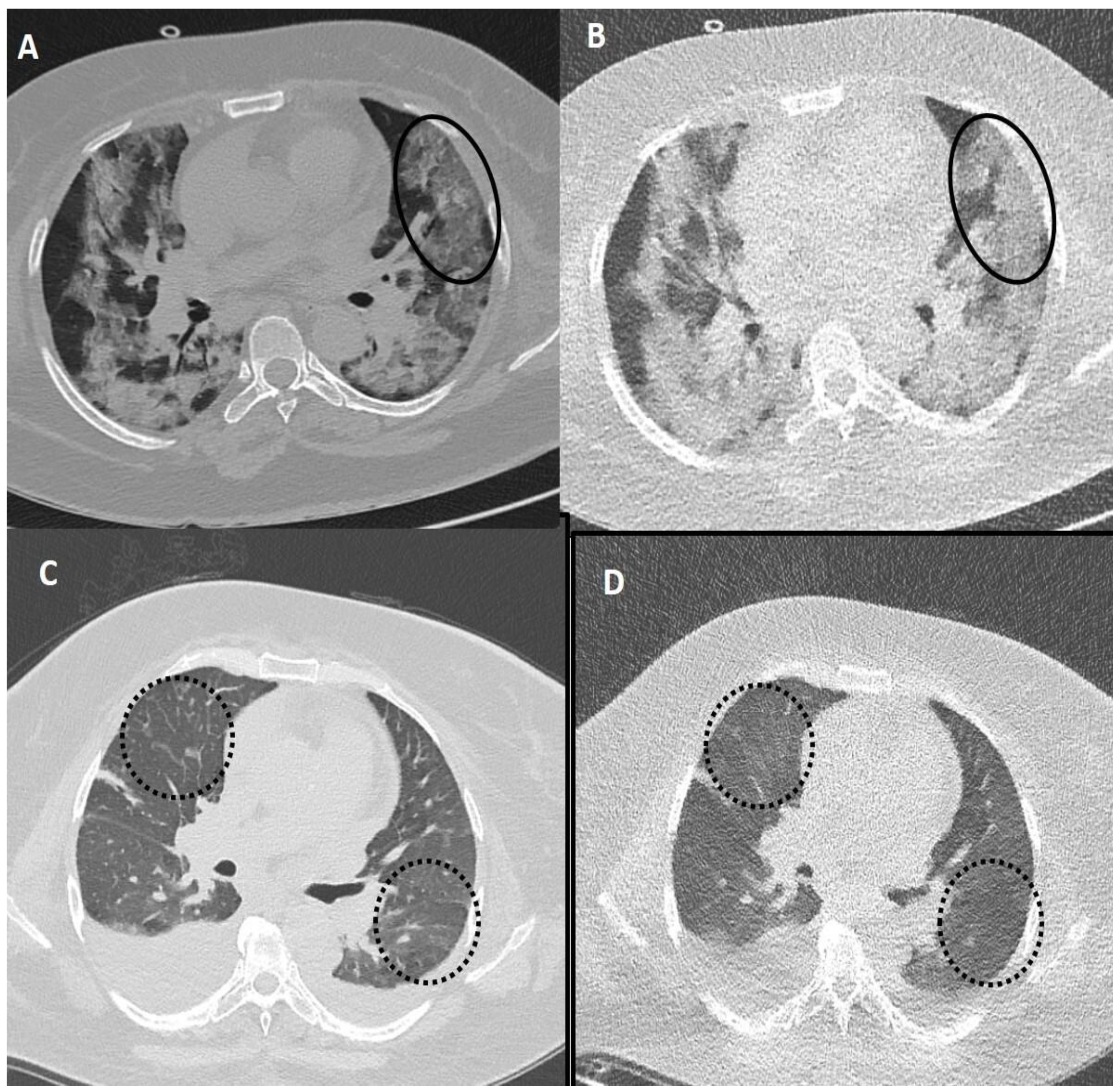Diagnostics 13 00351 g005 Diagnostics 13 00351 g005