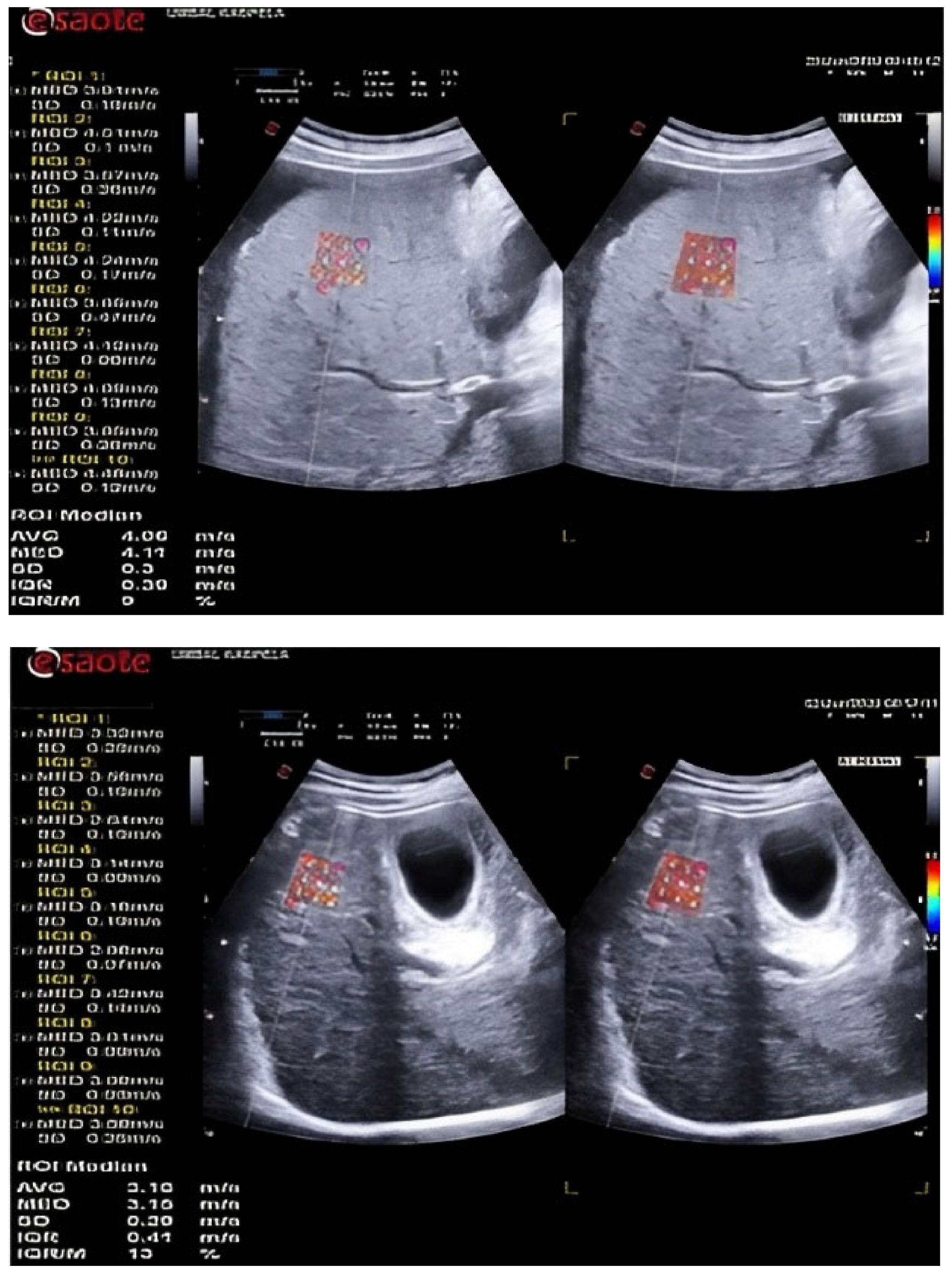 Diagnostics 13 00356 g001