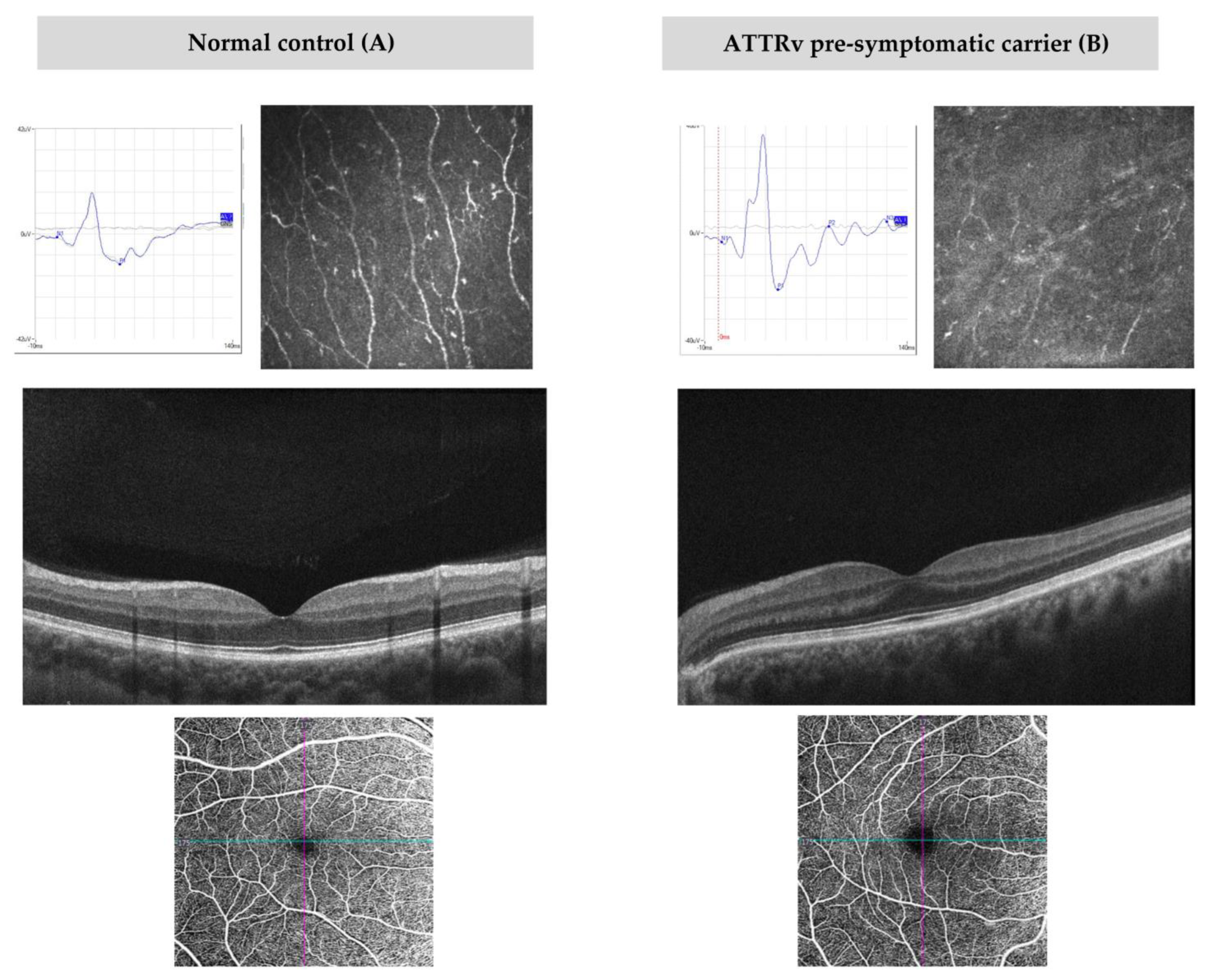 Diagnostics 13 00359 g001 Diagnostics 13 00359 g001