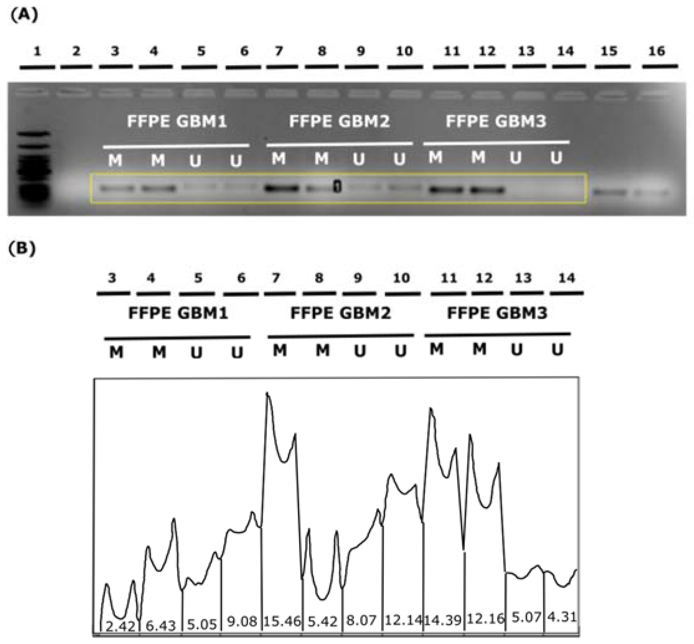Diagnostics 13 00360 g004