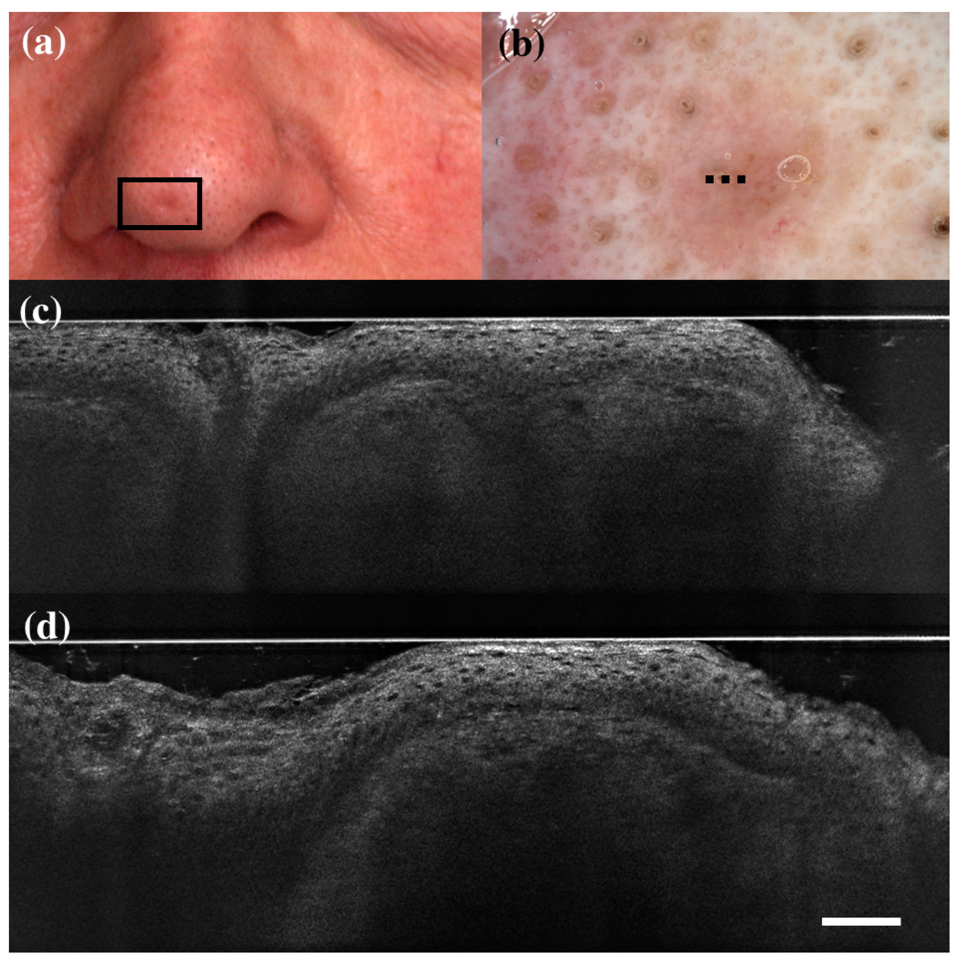 Diagnostics 13 00361 g001