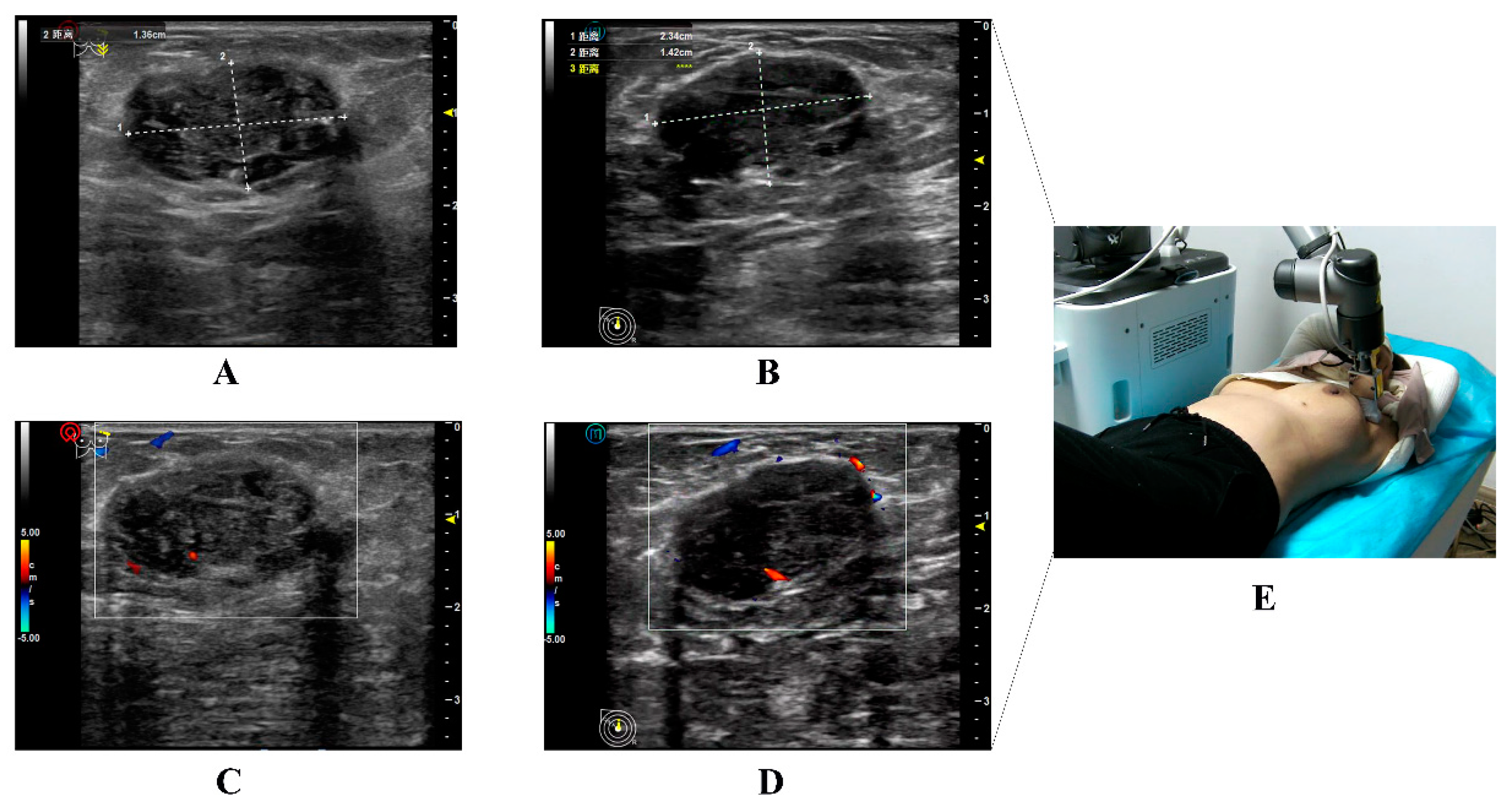 Diagnostics 13 00362 g004 Diagnostics 13 00362 g004