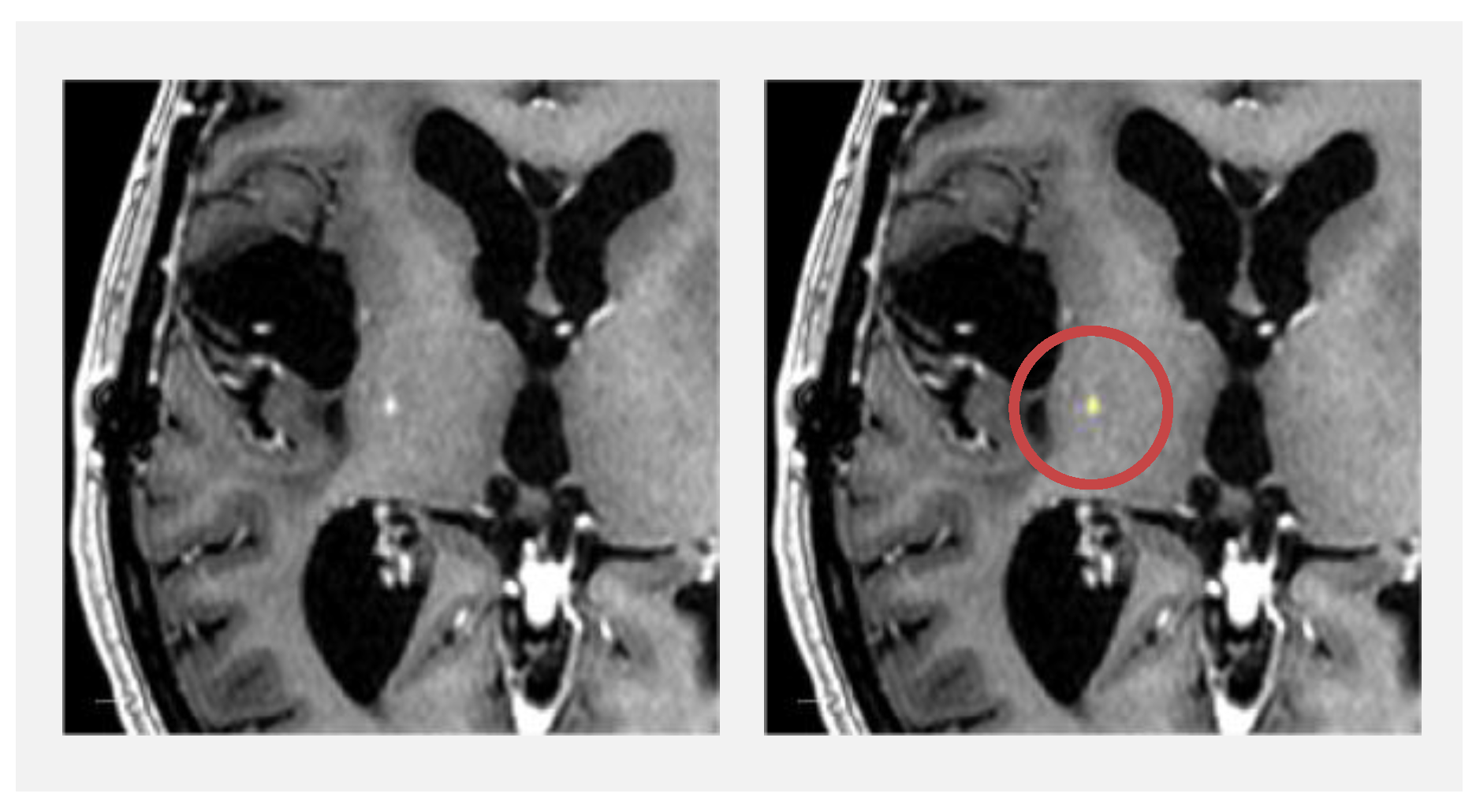 Diagnostics 13 00363 g006