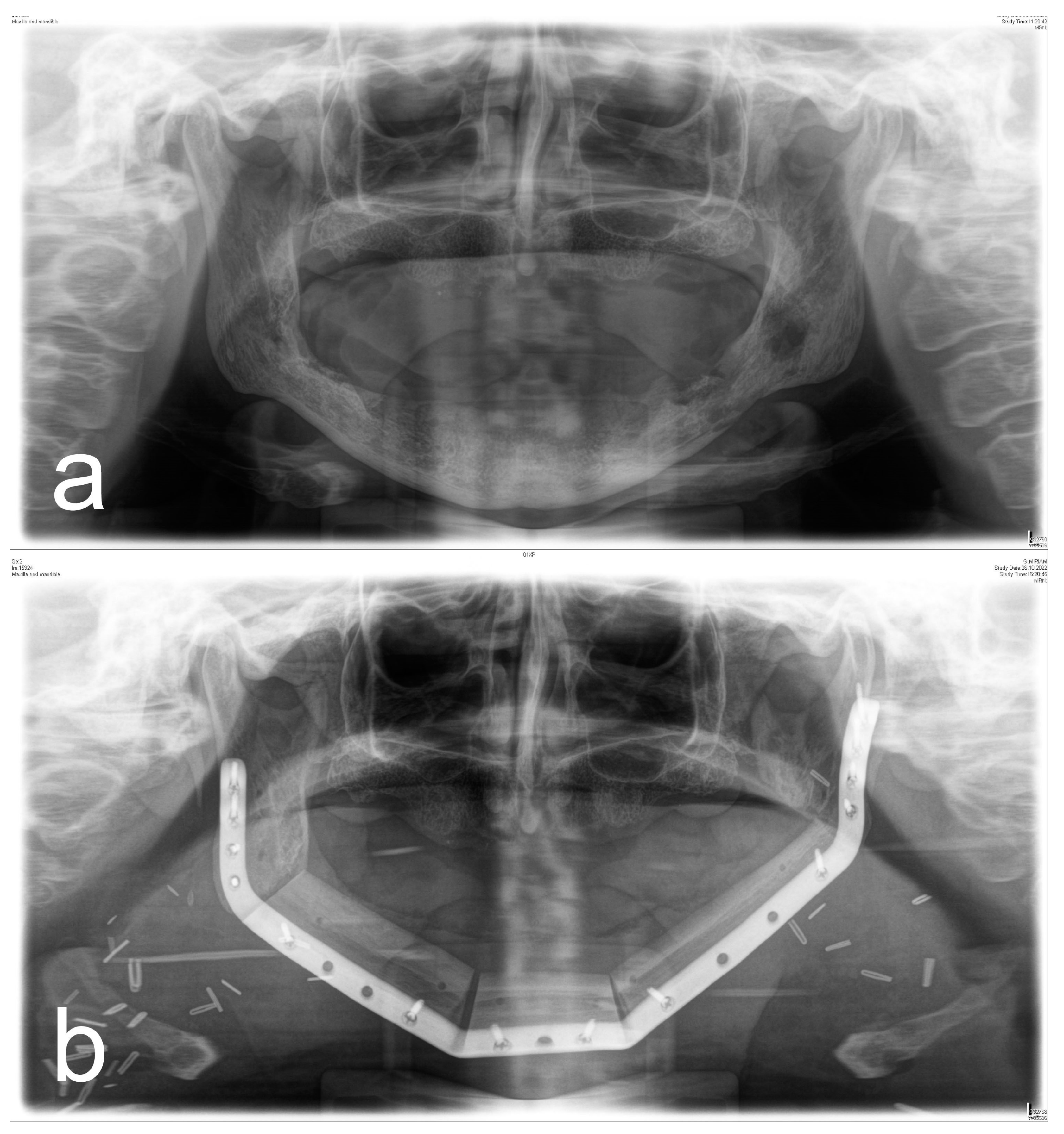 Diagnostics 13 00366 g003