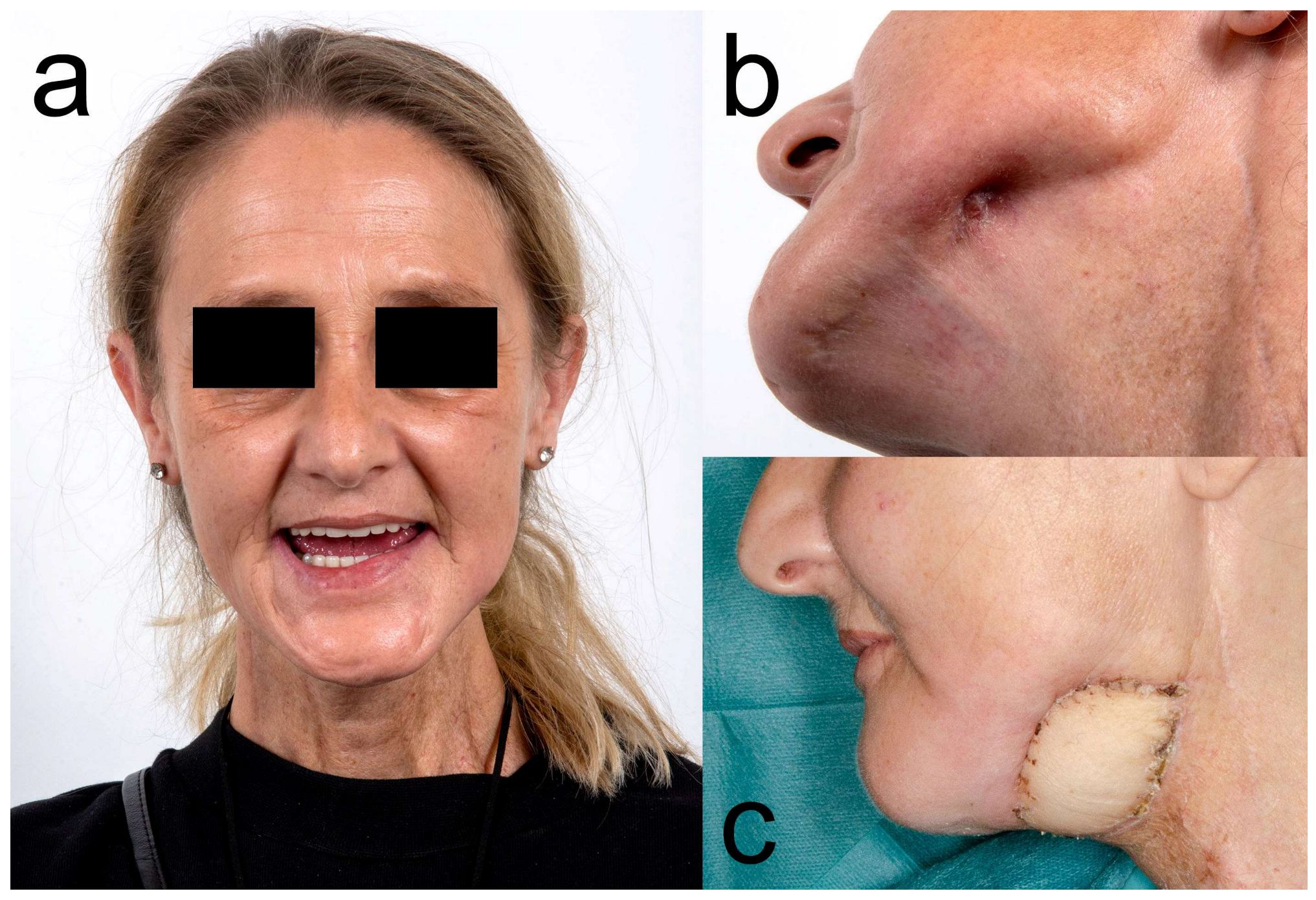 Diagnostics 13 00366 g004