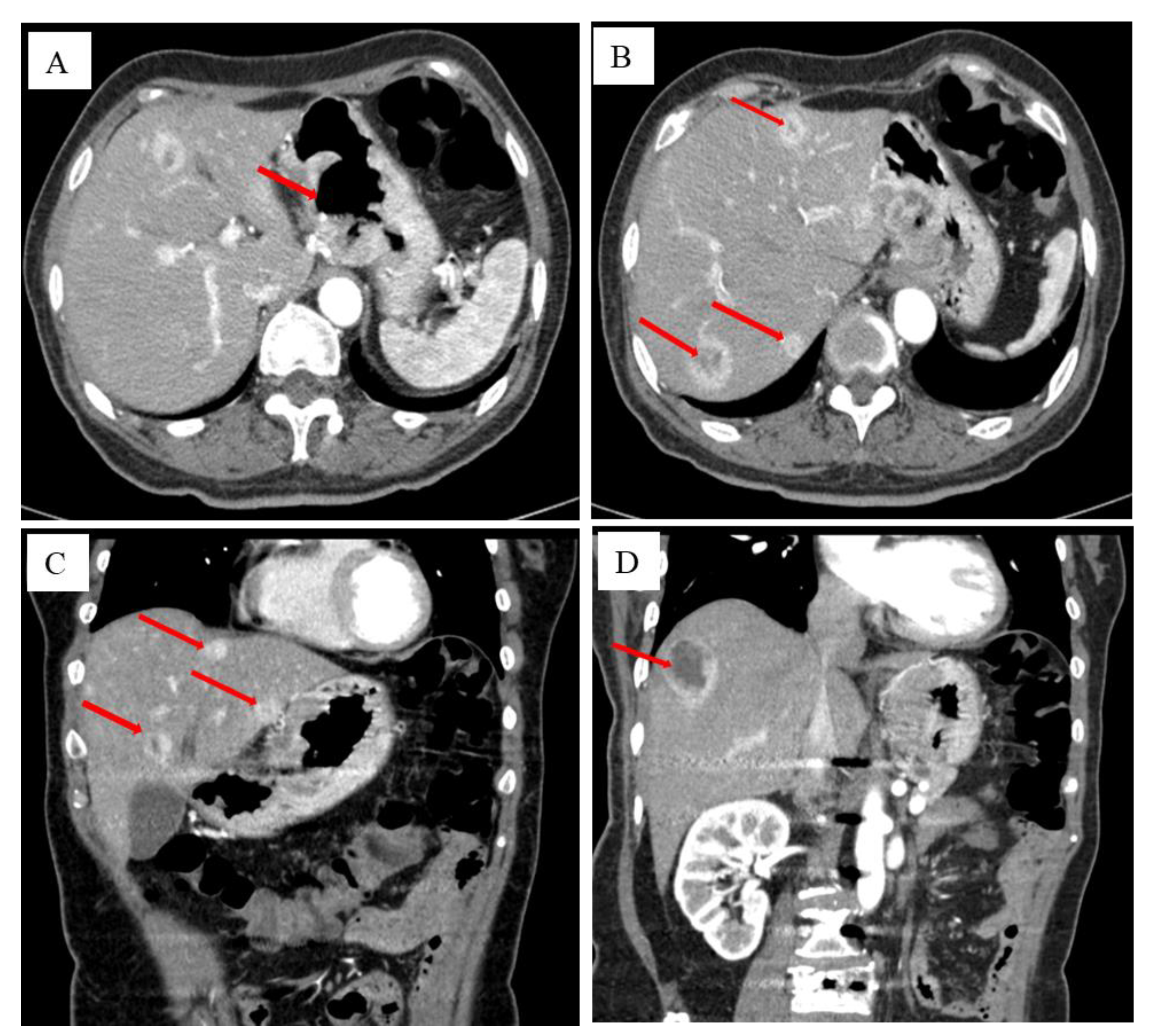 Diagnostics 13 00376 g002