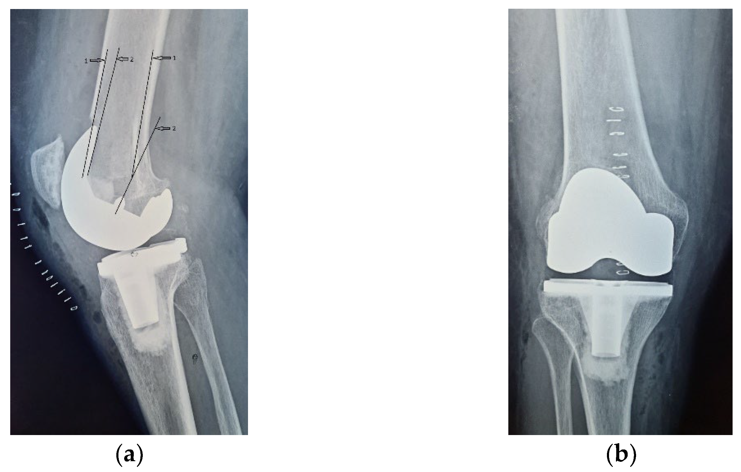 Diagnostics 13 00383 g001