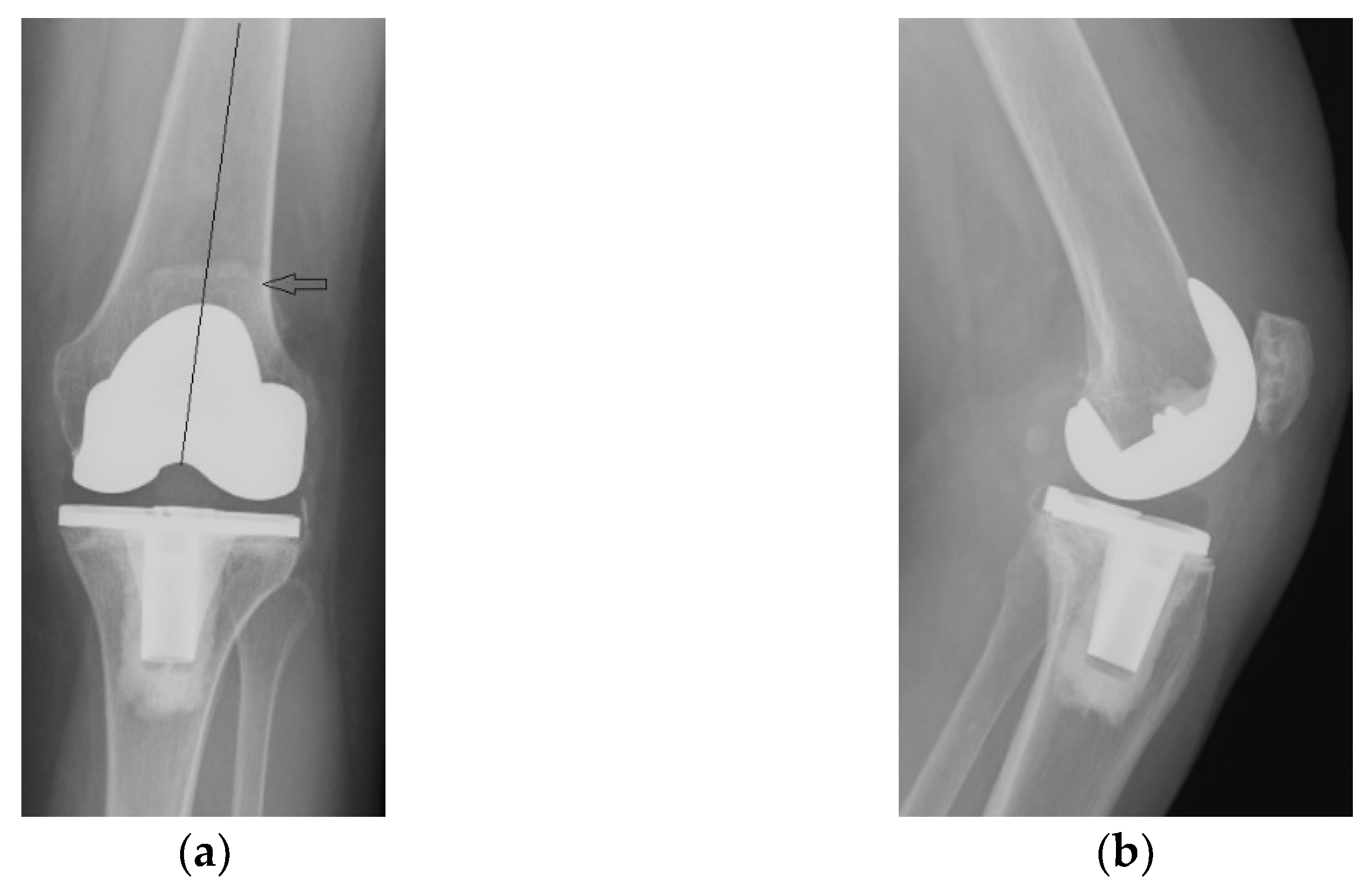 Diagnostics 13 00383 g008
