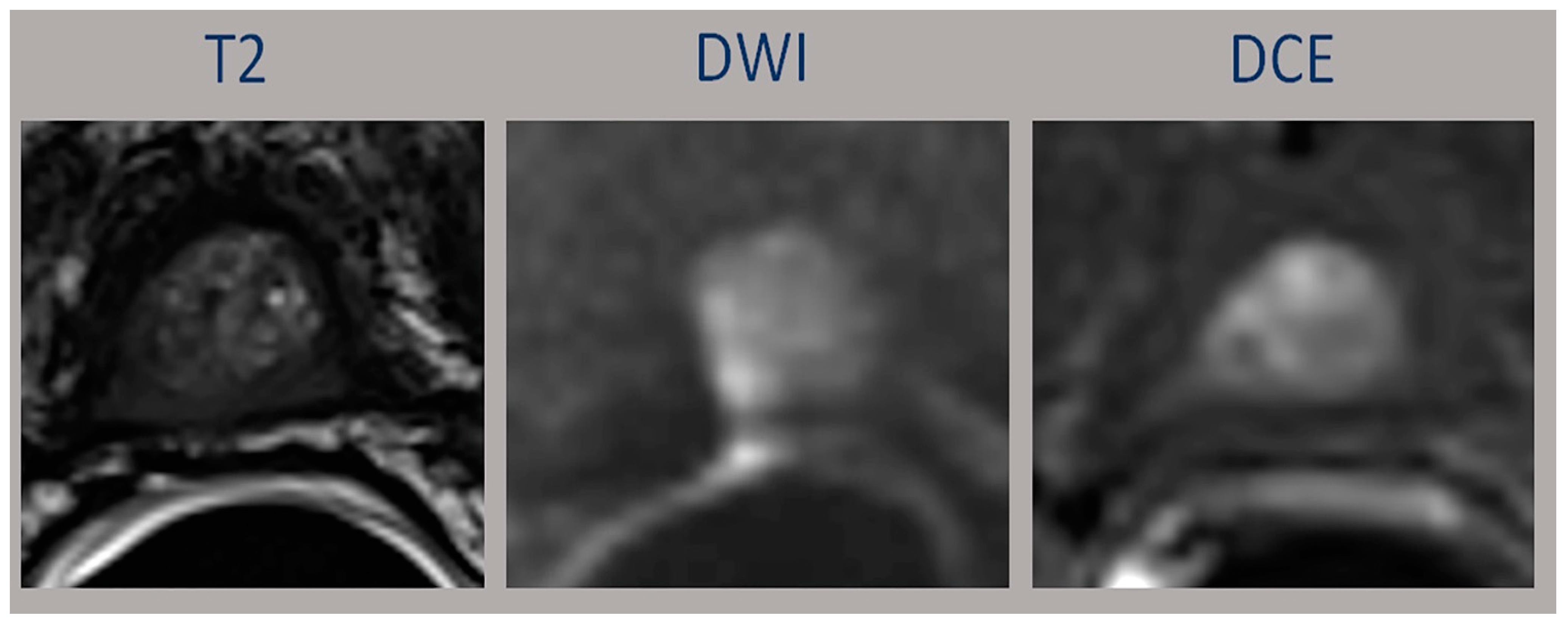 Diagnostics 13 00387 g003