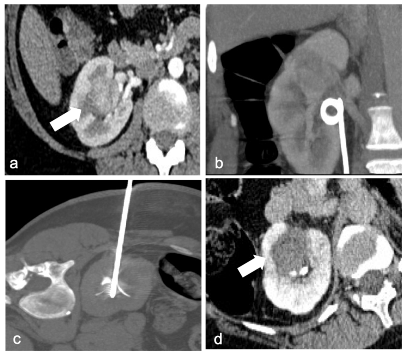 Diagnostics 13 00388 g001 Diagnostics 13 00388 g001