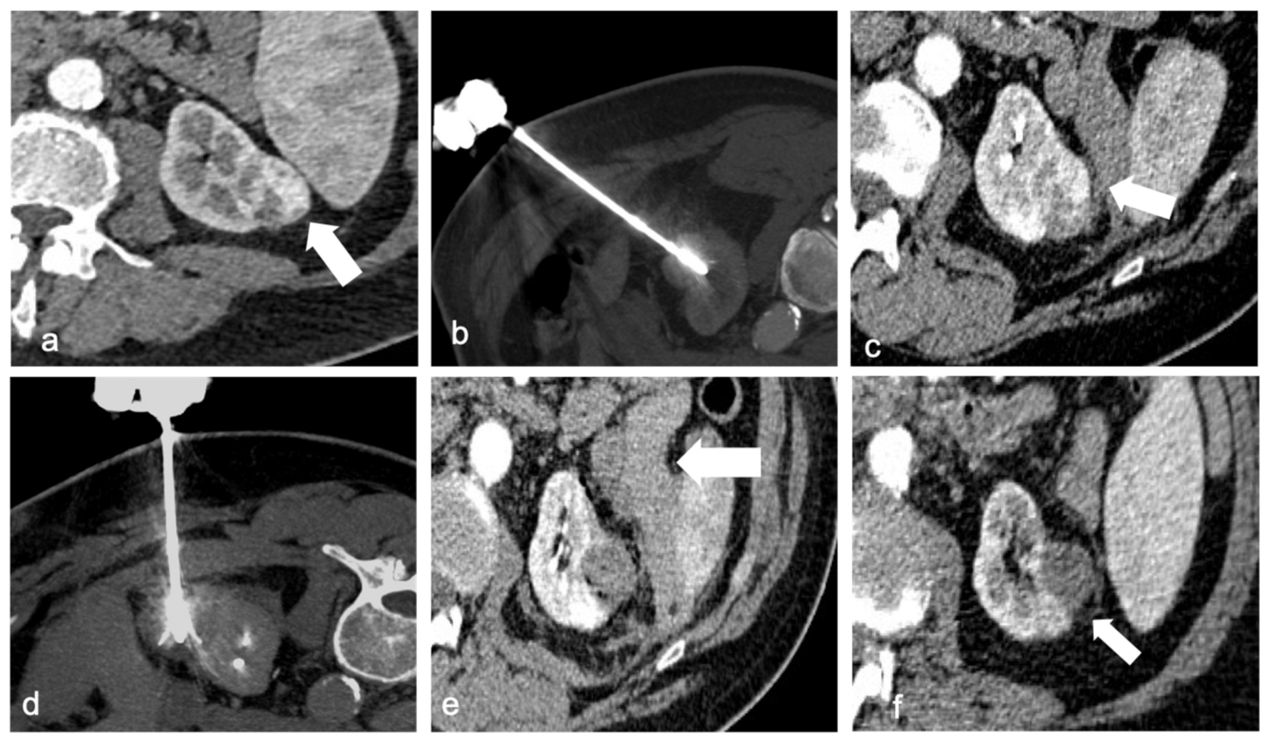 Diagnostics 13 00388 g002 Diagnostics 13 00388 g002