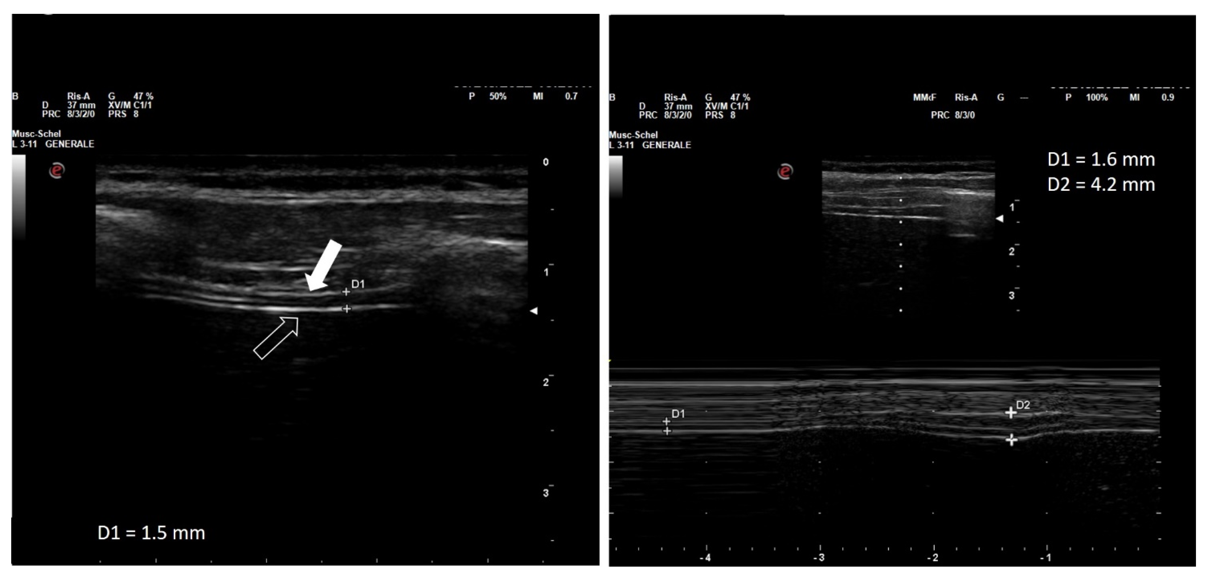 Diagnostics 13 00411 g001 Diagnostics 13 00411 g001