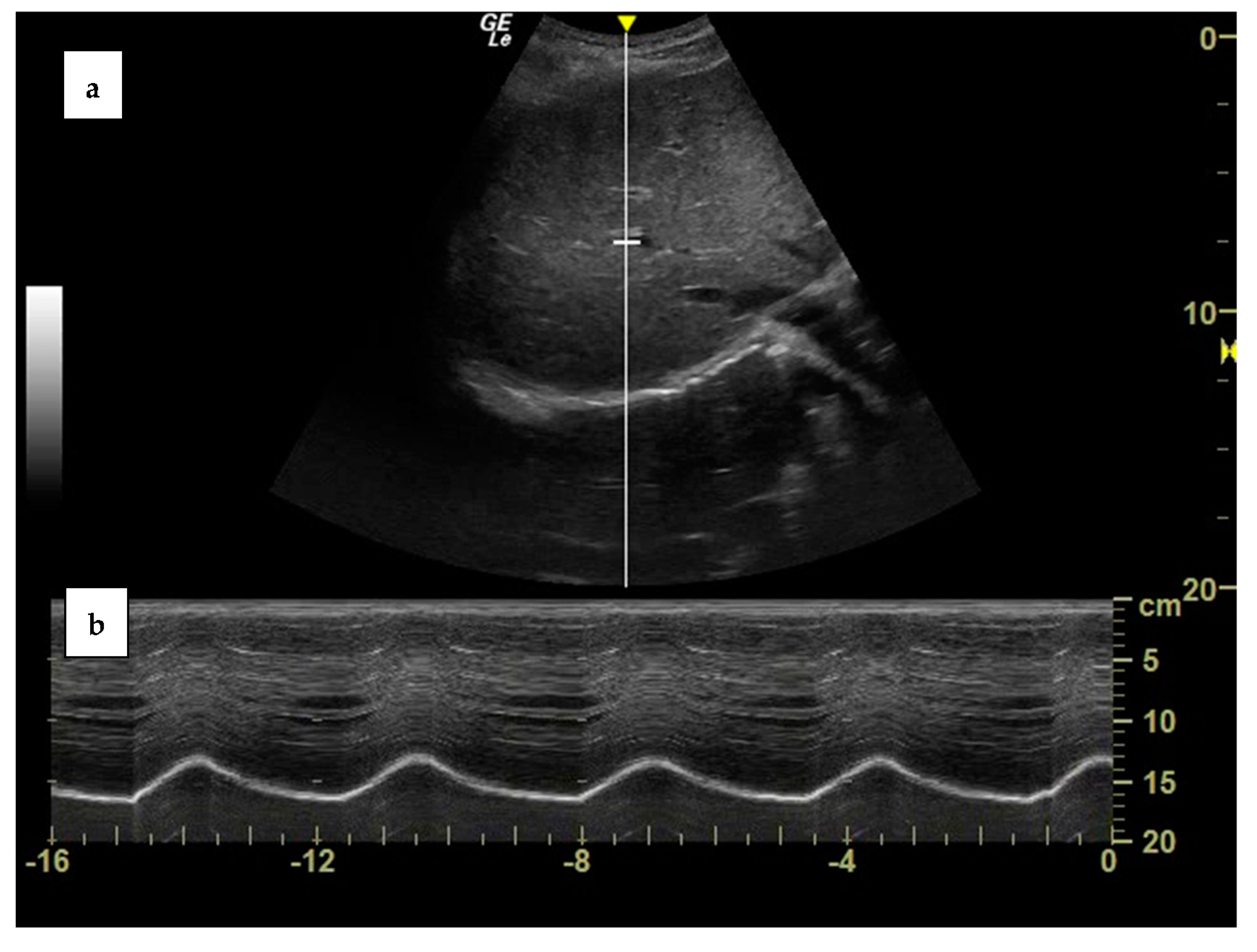 Diagnostics 13 00411 g002 Diagnostics 13 00411 g002