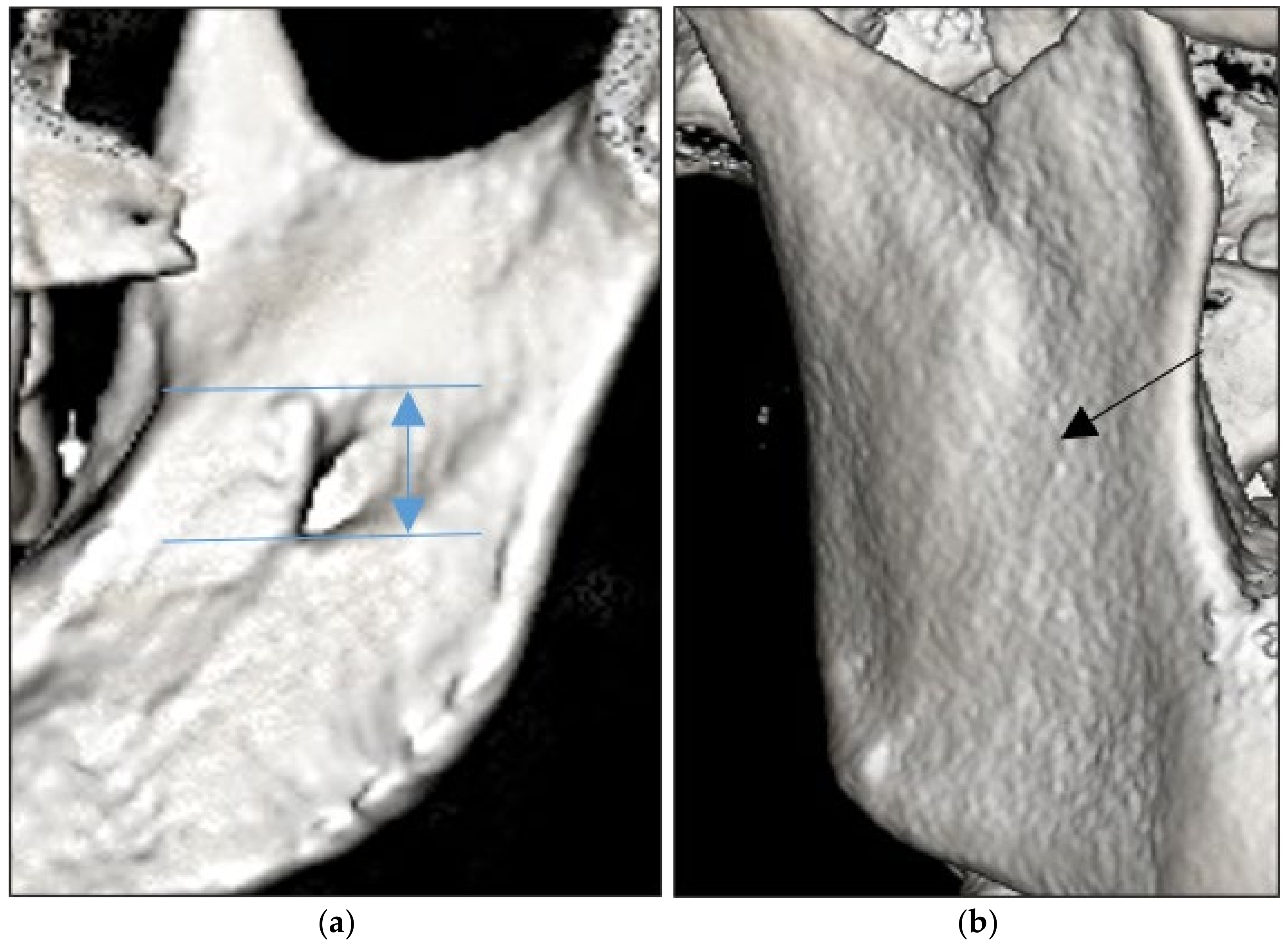 Diagnostics 13 00419 g001 Diagnostics 13 00419 g001