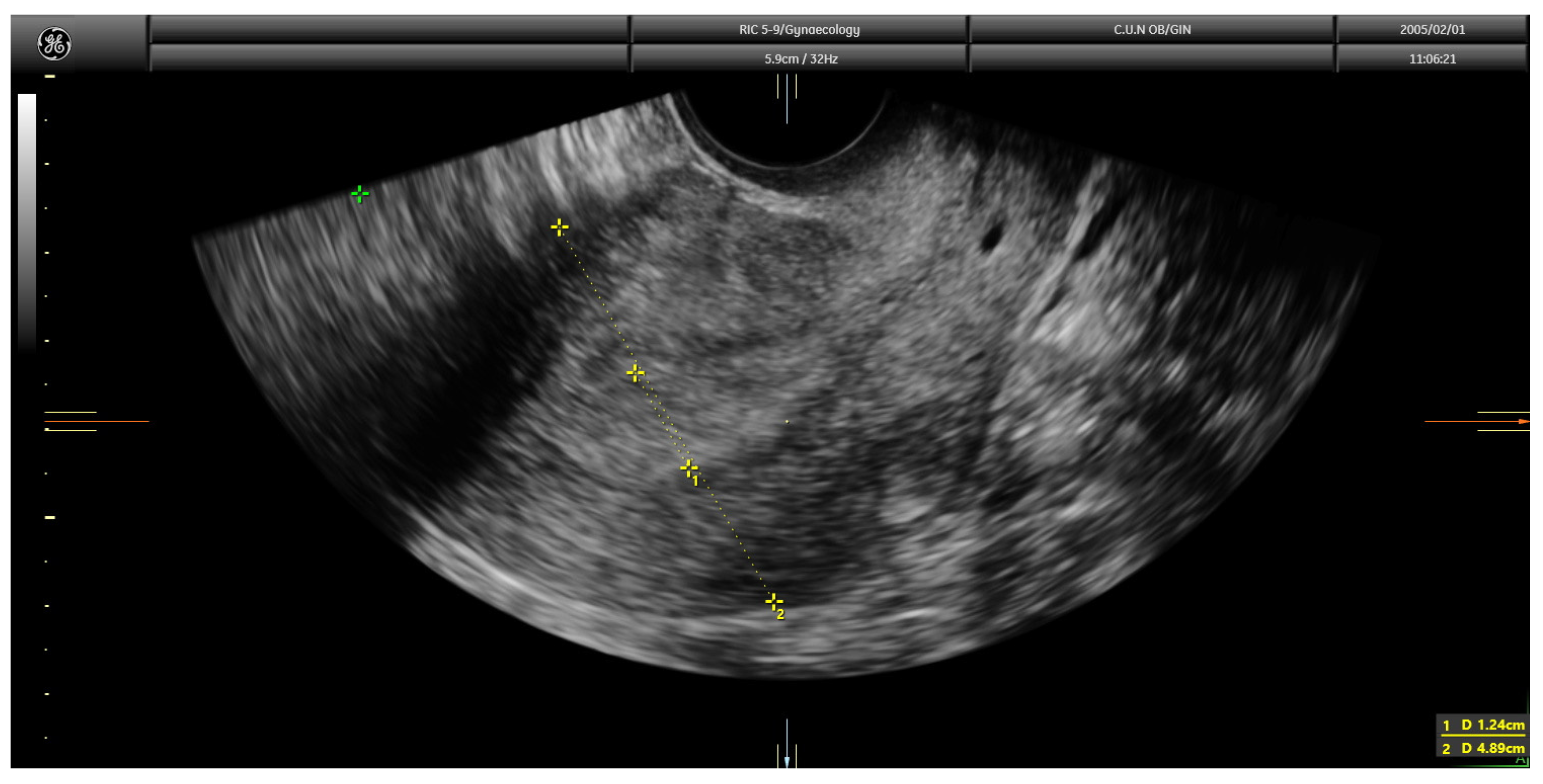 Diagnostics 13 00425 g002