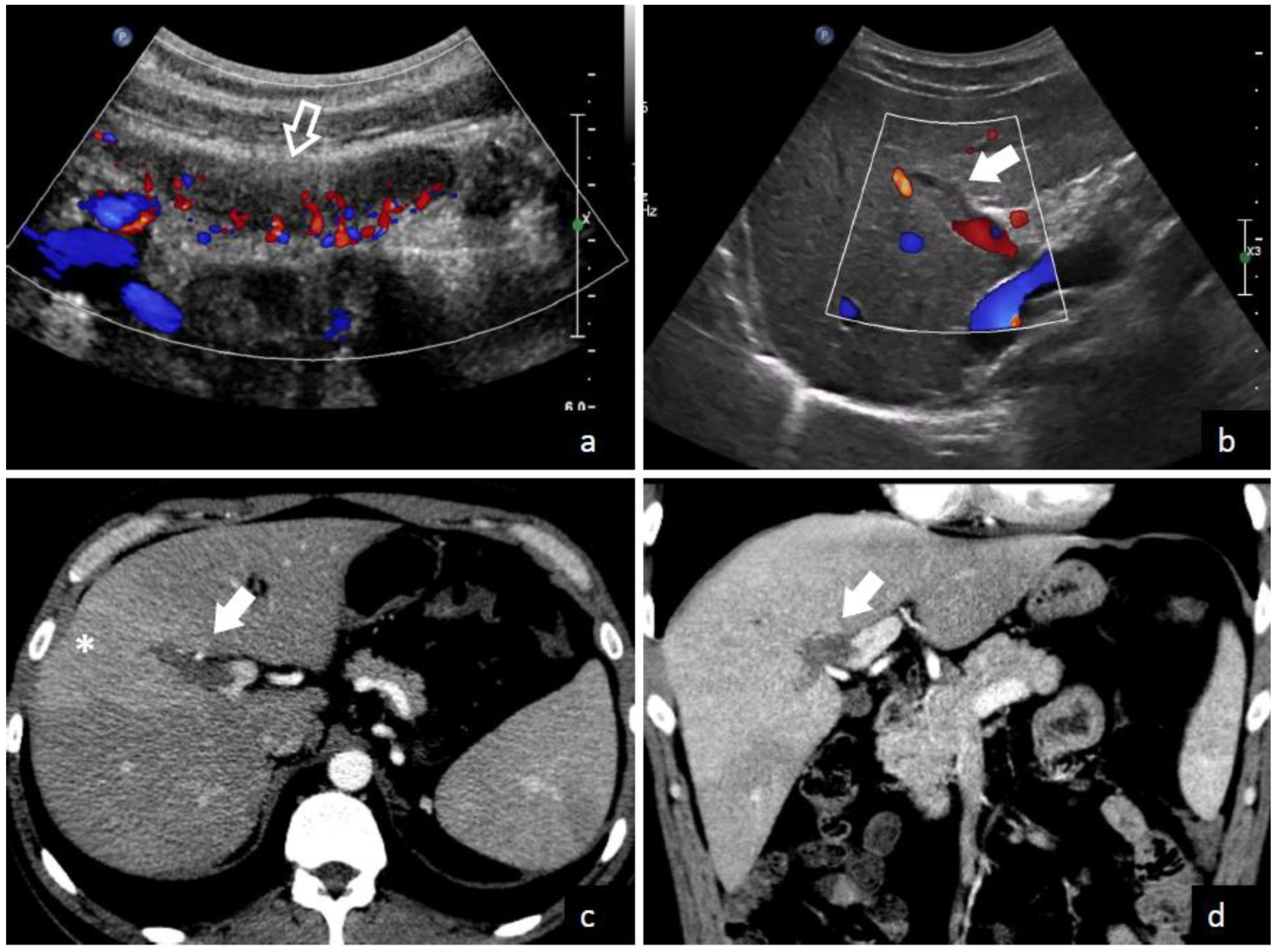Diagnostics 13 00429 g003