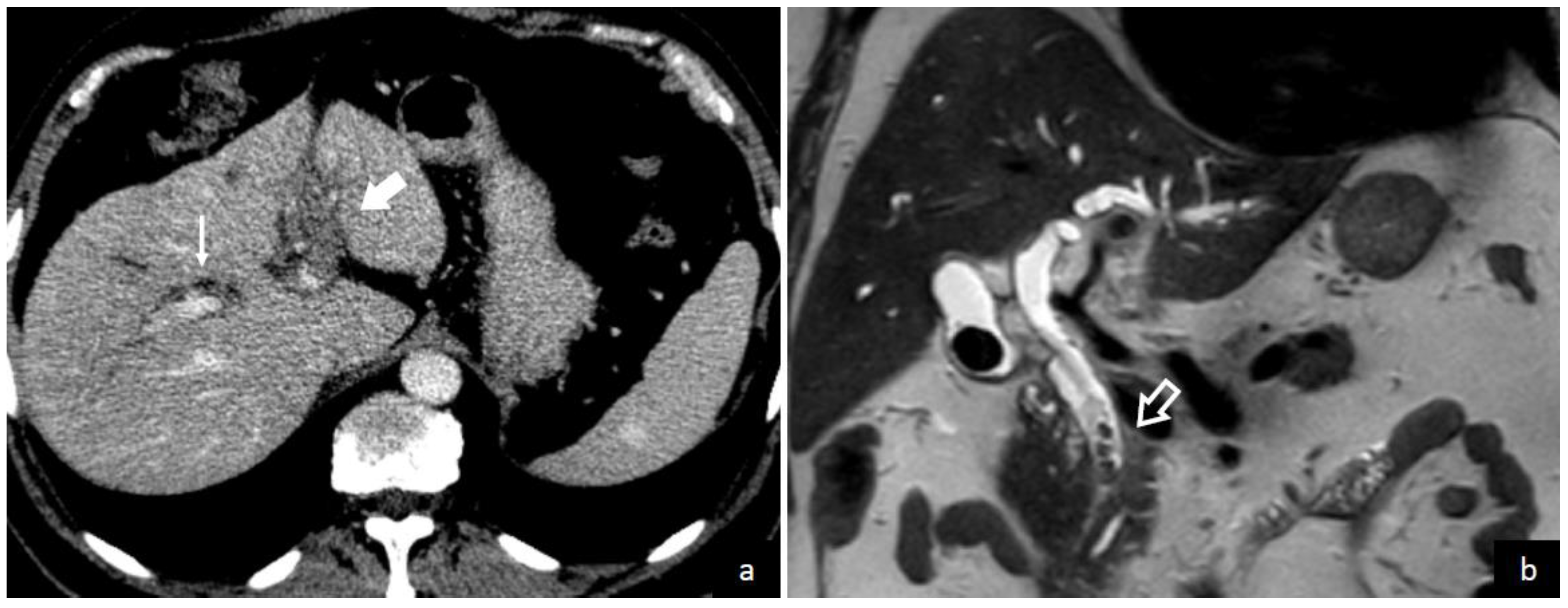 Diagnostics 13 00429 g004