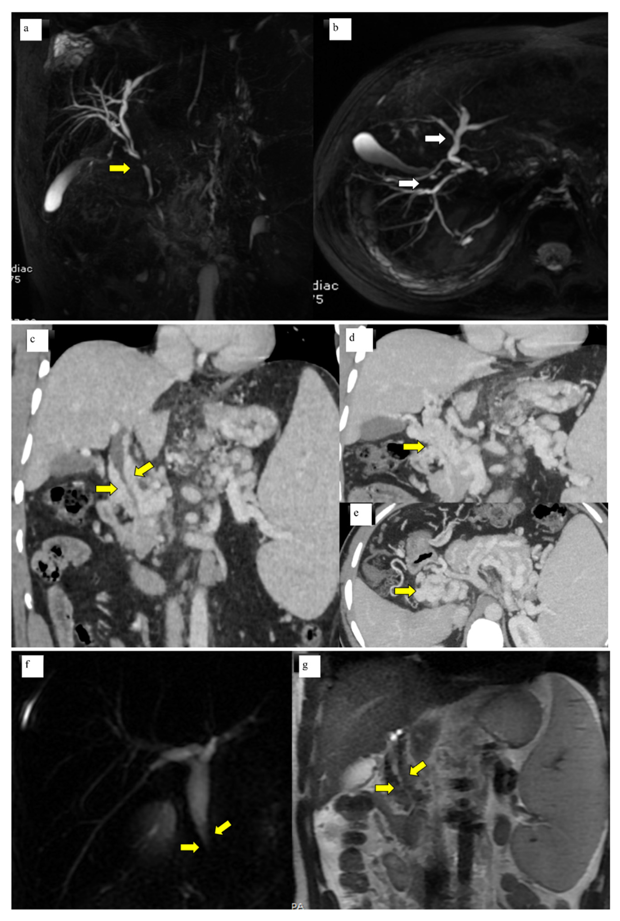 Diagnostics 13 00436 g001