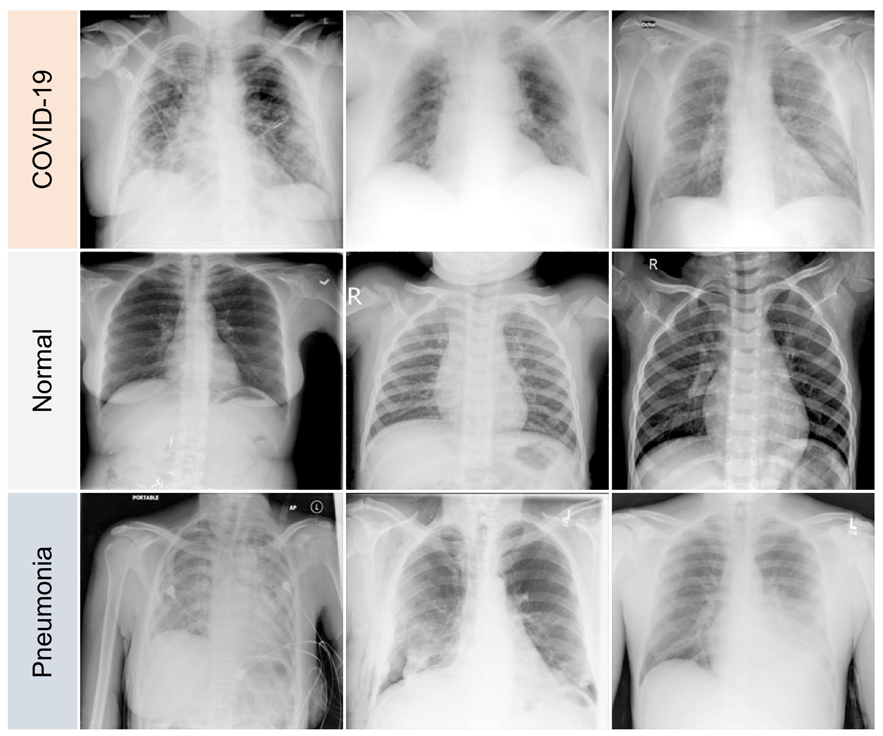 Diagnostics 13 00441 g003