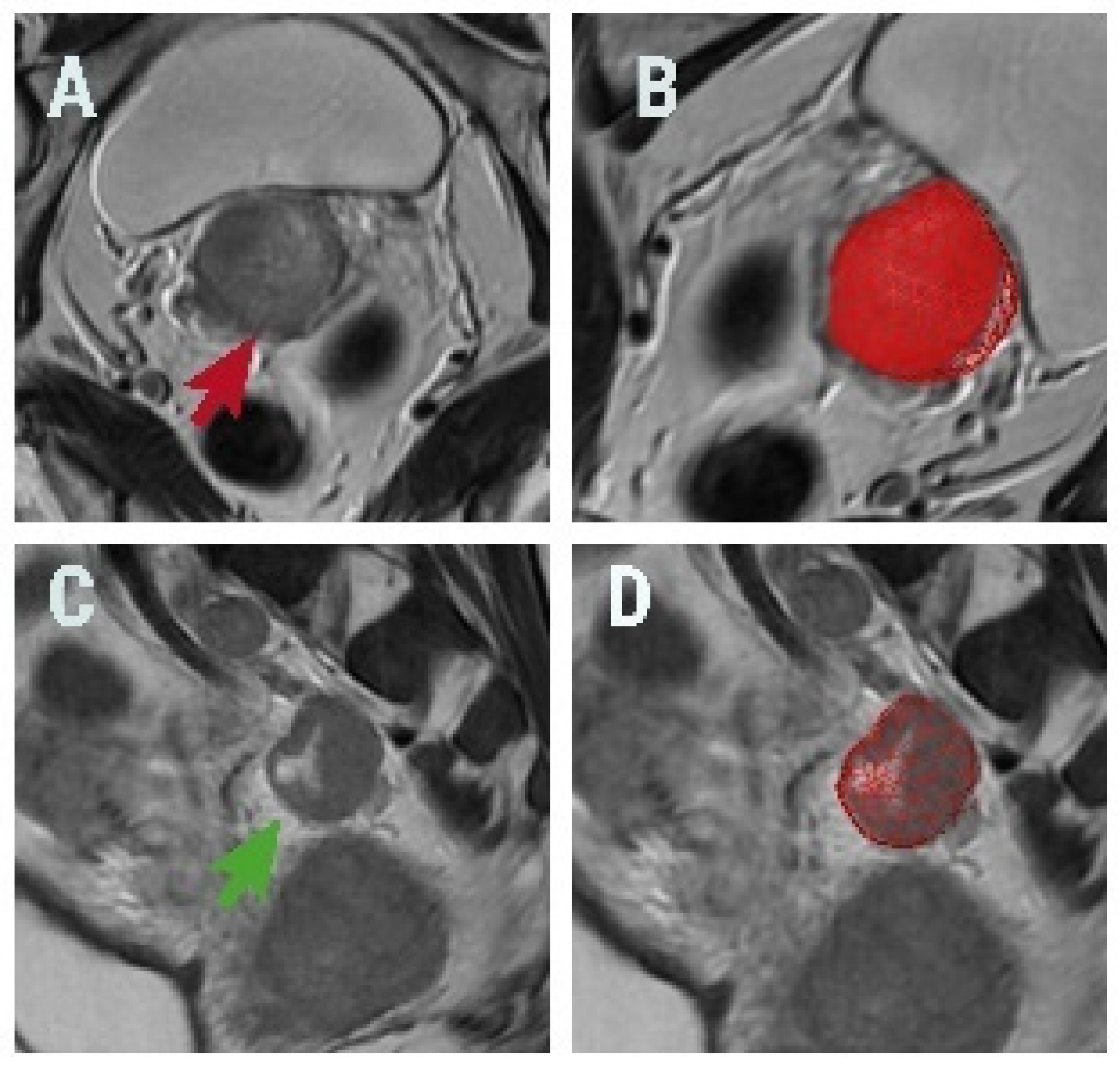 Diagnostics 13 00442 g001 Diagnostics 13 00442 g001