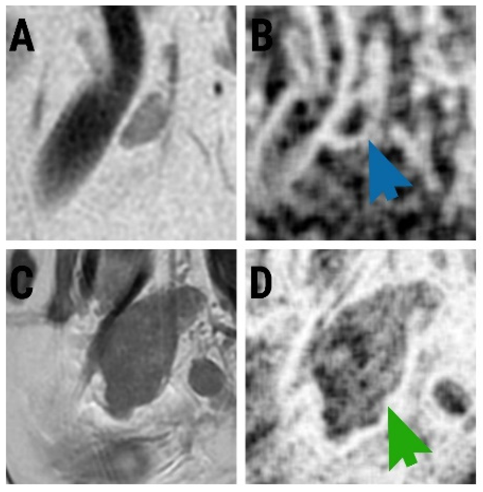 Diagnostics 13 00442 g003 Diagnostics 13 00442 g003