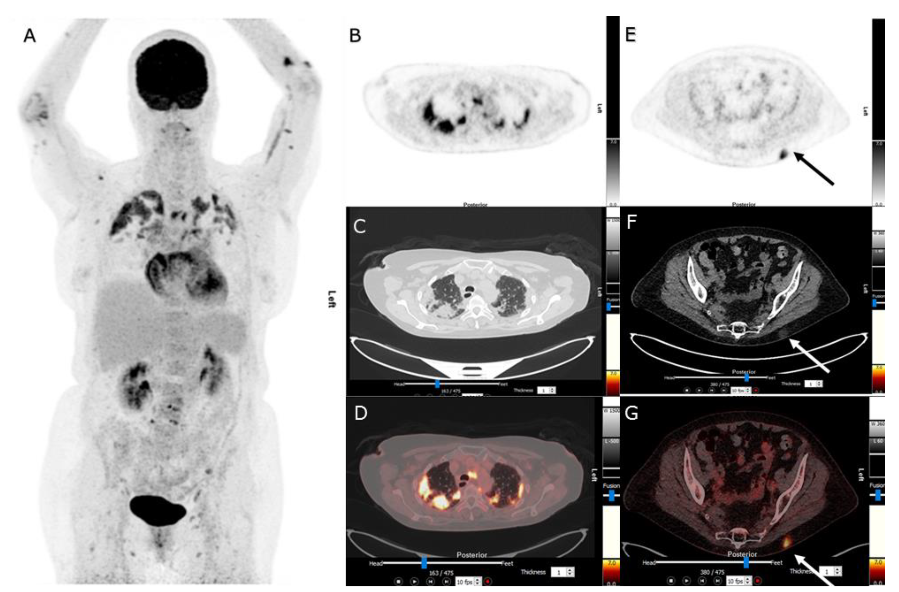 Diagnostics 13 00444 g001