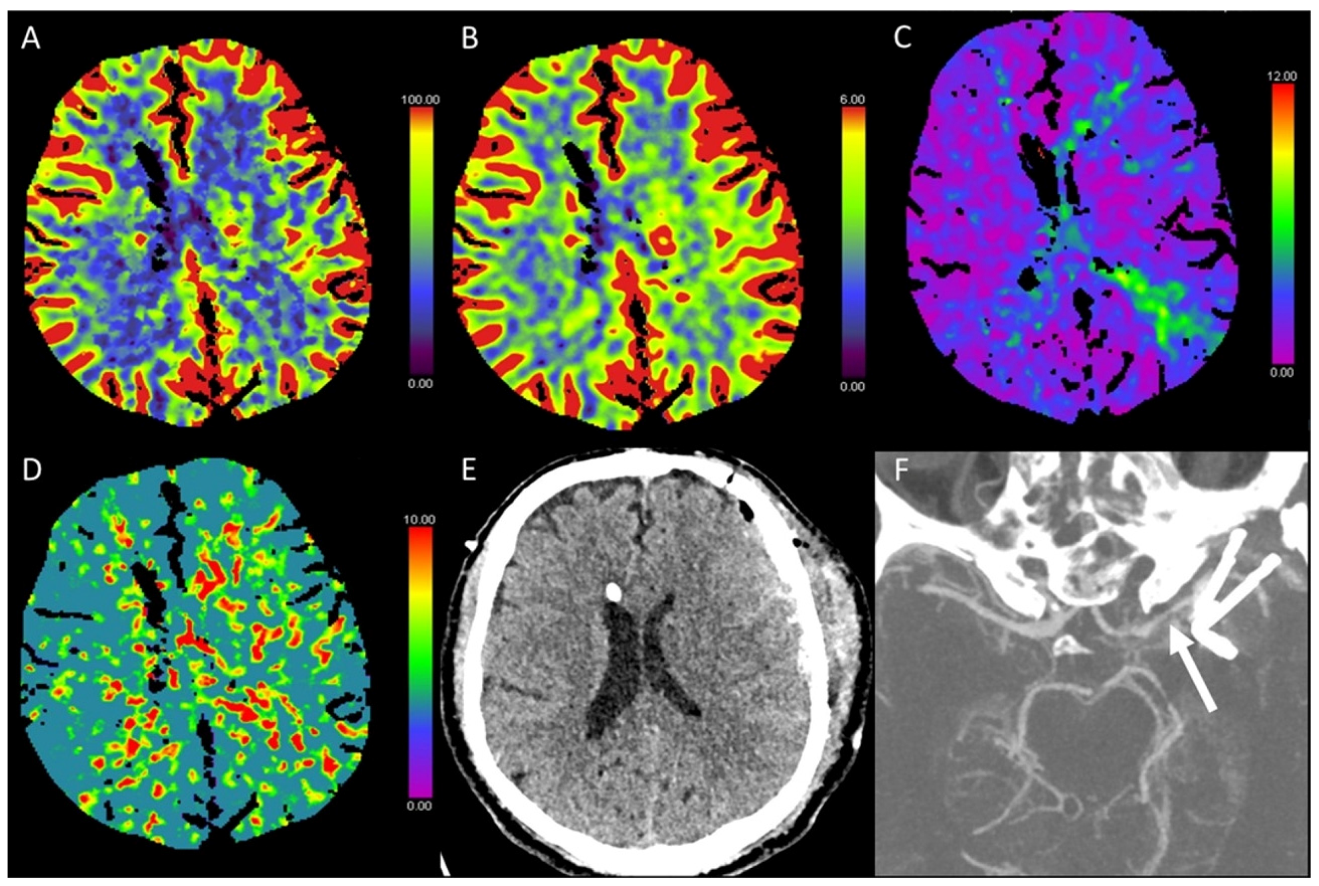 Diagnostics 13 00447 g011