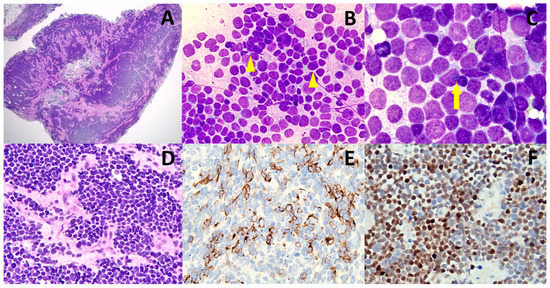 Diagnostics 13 00449 g001