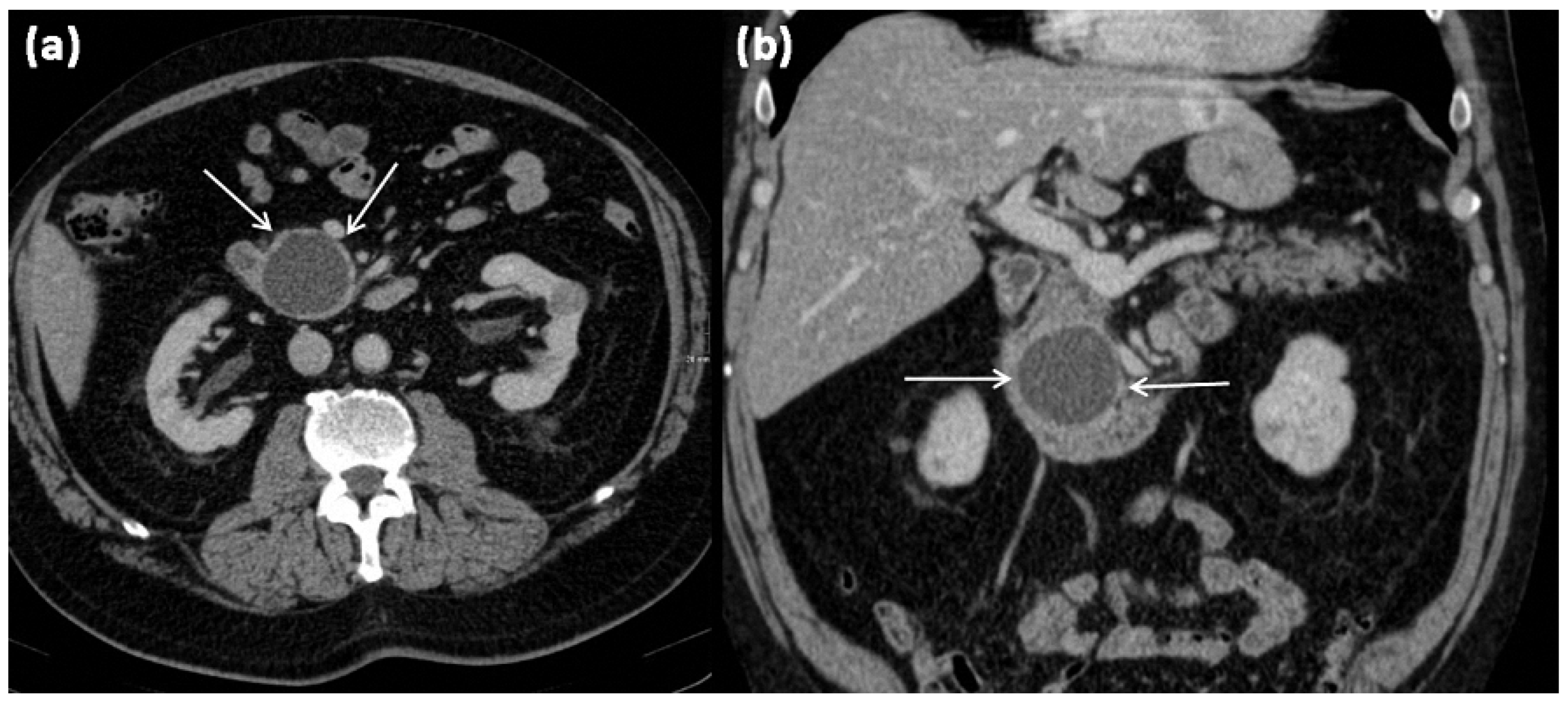 Diagnostics 13 00454 g001