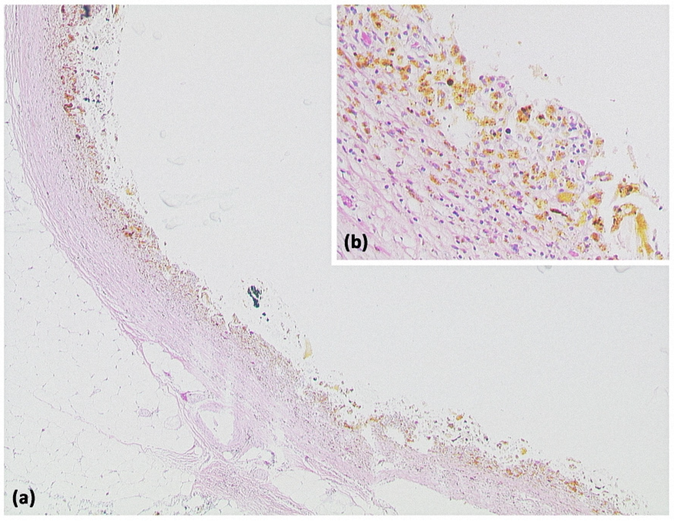 Diagnostics 13 00454 g002