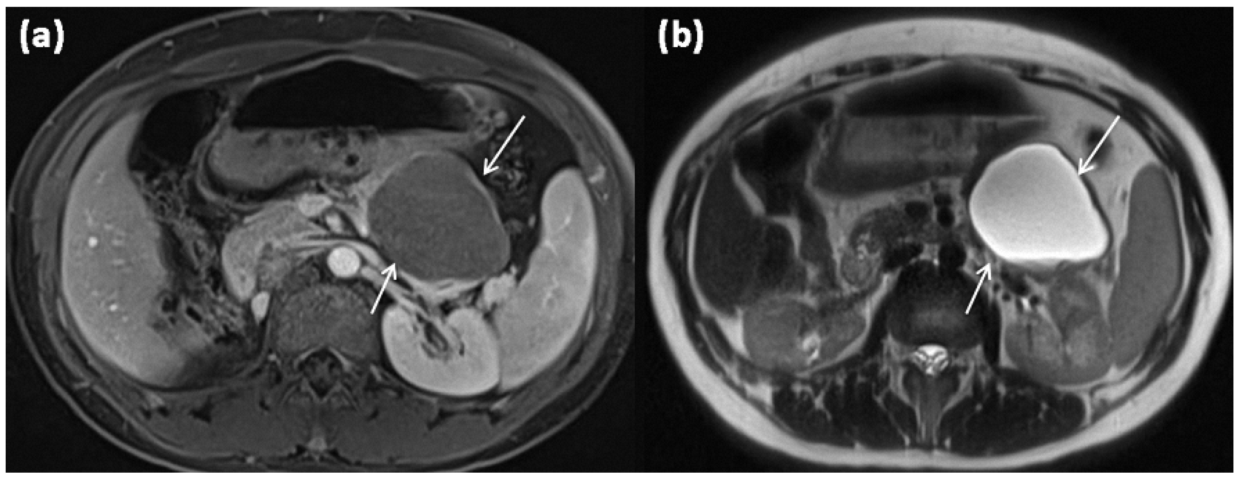 Diagnostics 13 00454 g003