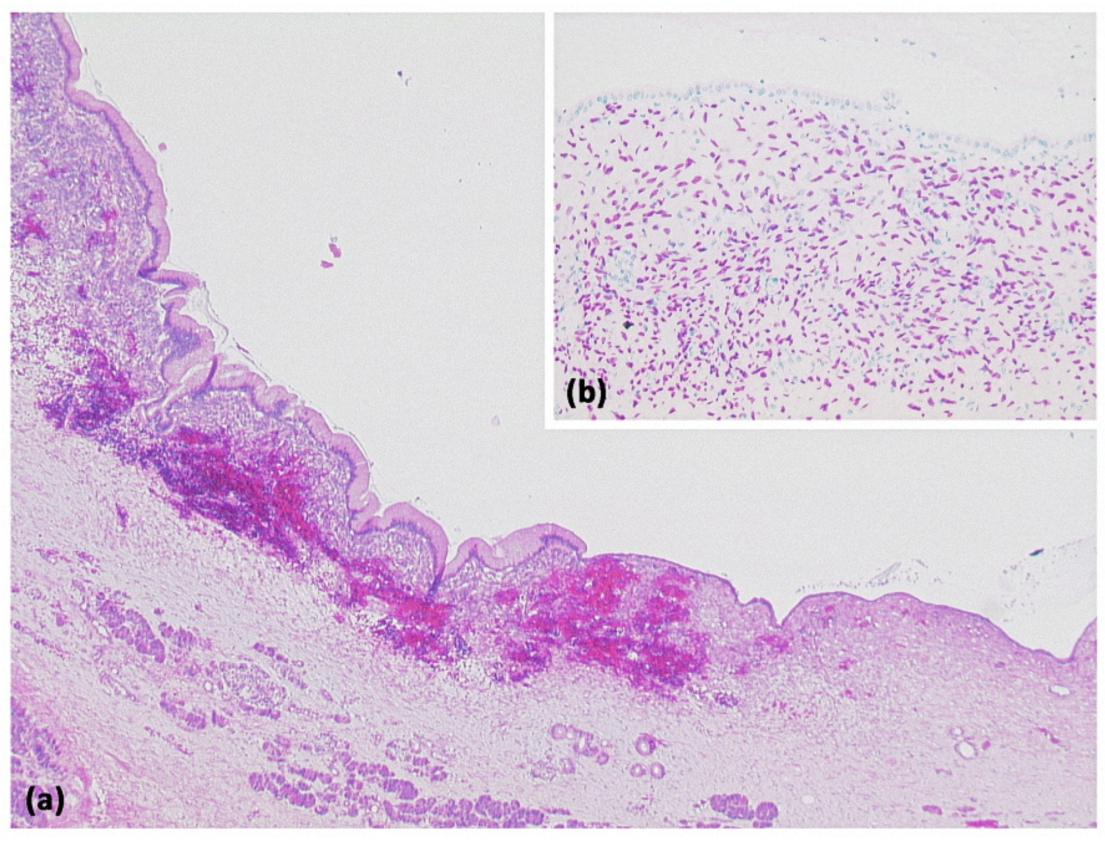 Diagnostics 13 00454 g006