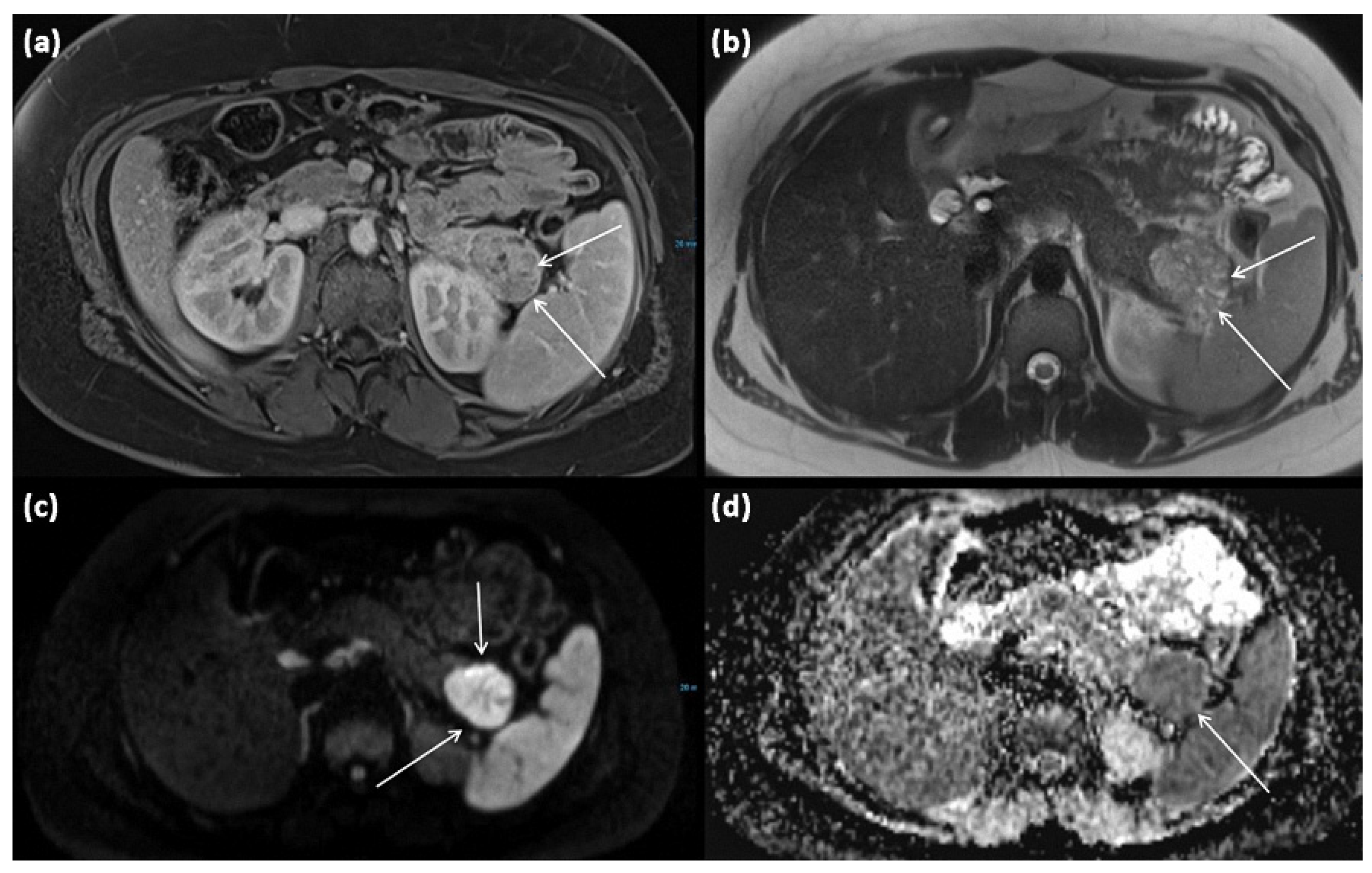 Diagnostics 13 00454 g009