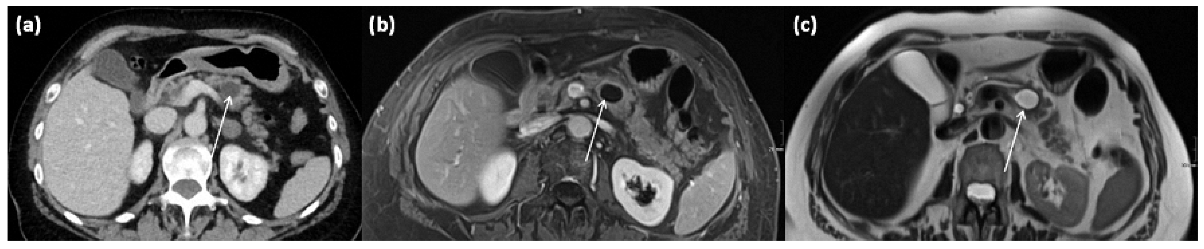 Diagnostics 13 00454 g011