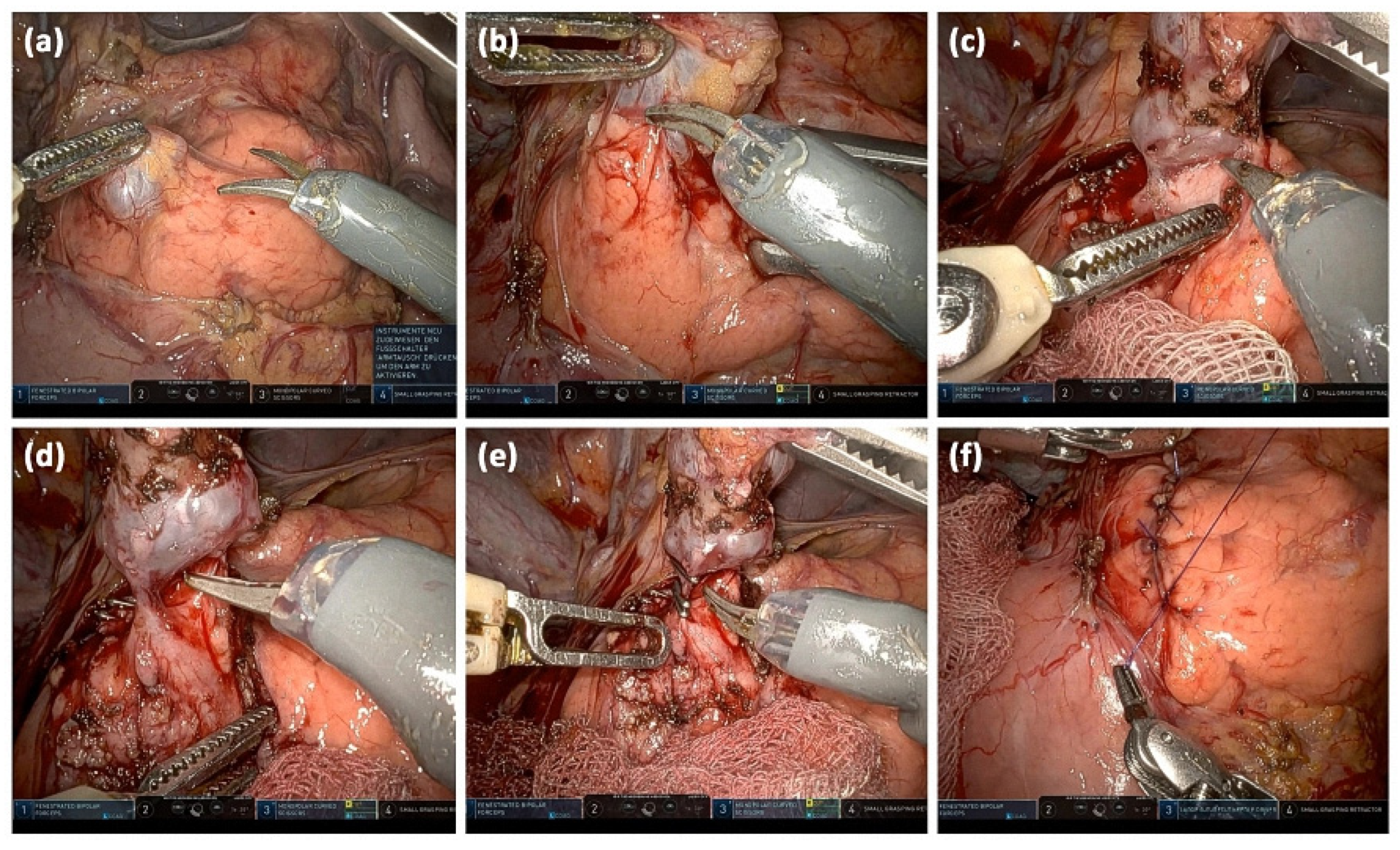 Diagnostics 13 00454 g013