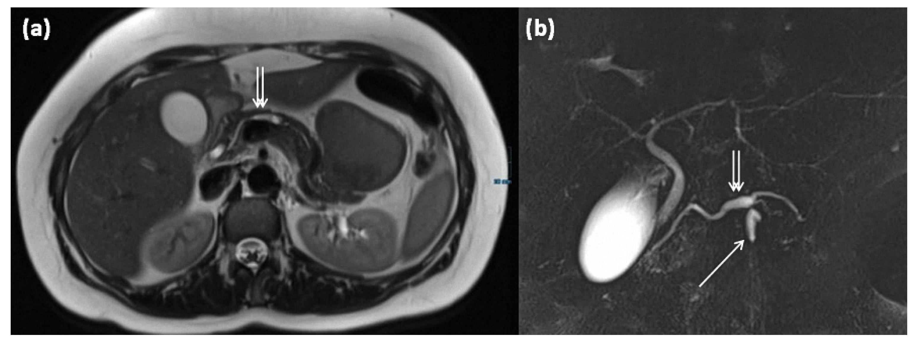Diagnostics 13 00454 g015