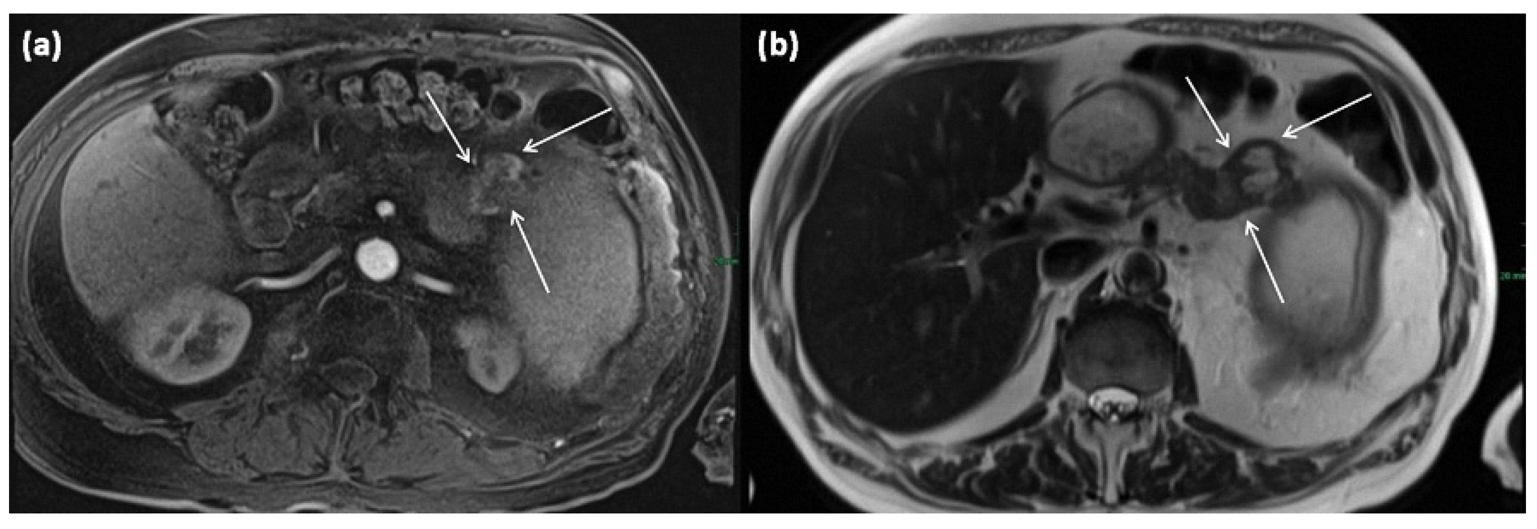 Diagnostics 13 00454 g016