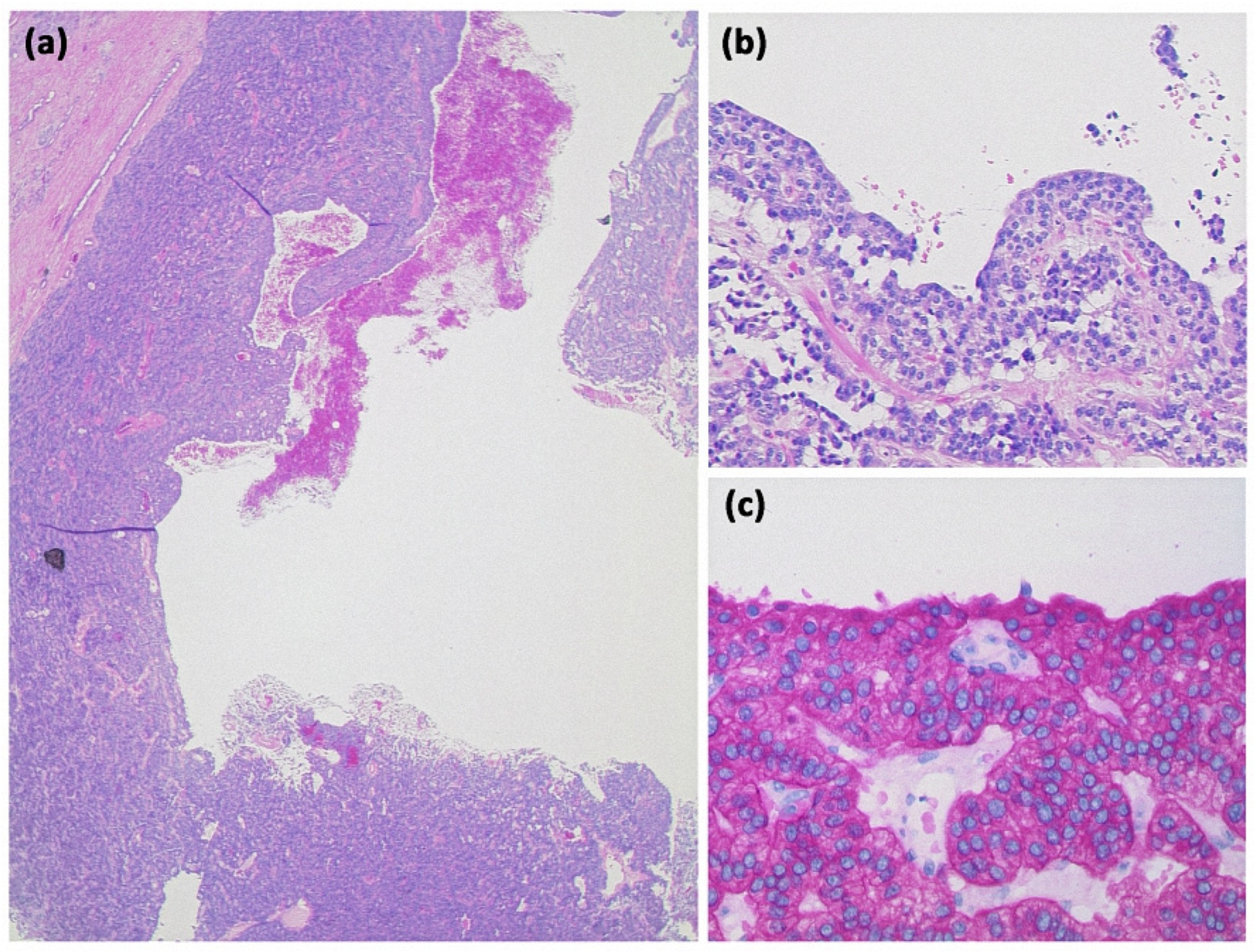 Diagnostics 13 00454 g017