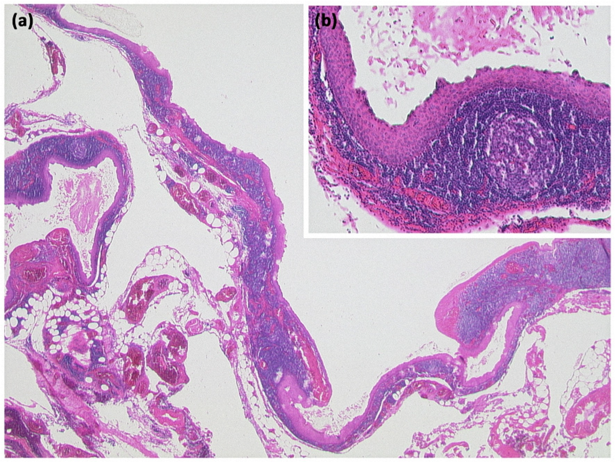 Diagnostics 13 00454 g018