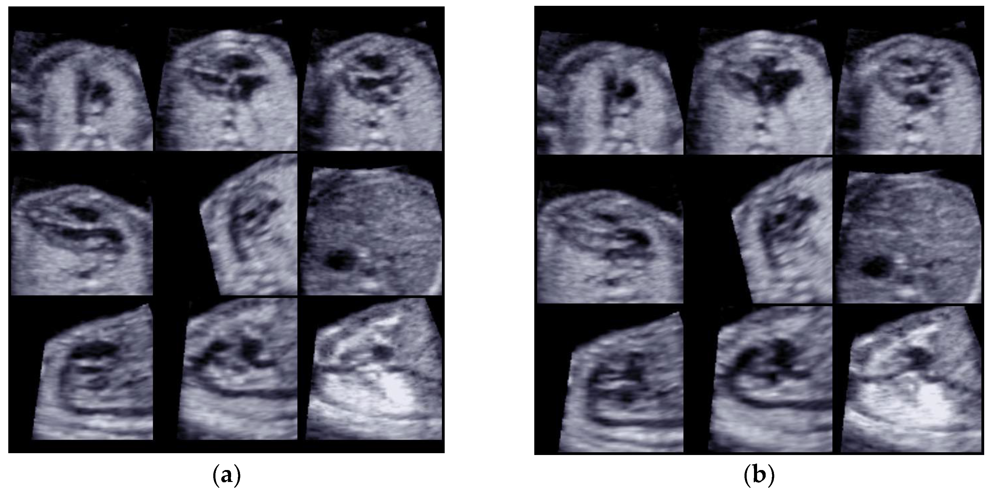 Diagnostics 13 00456 g001 Diagnostics 13 00456 g001