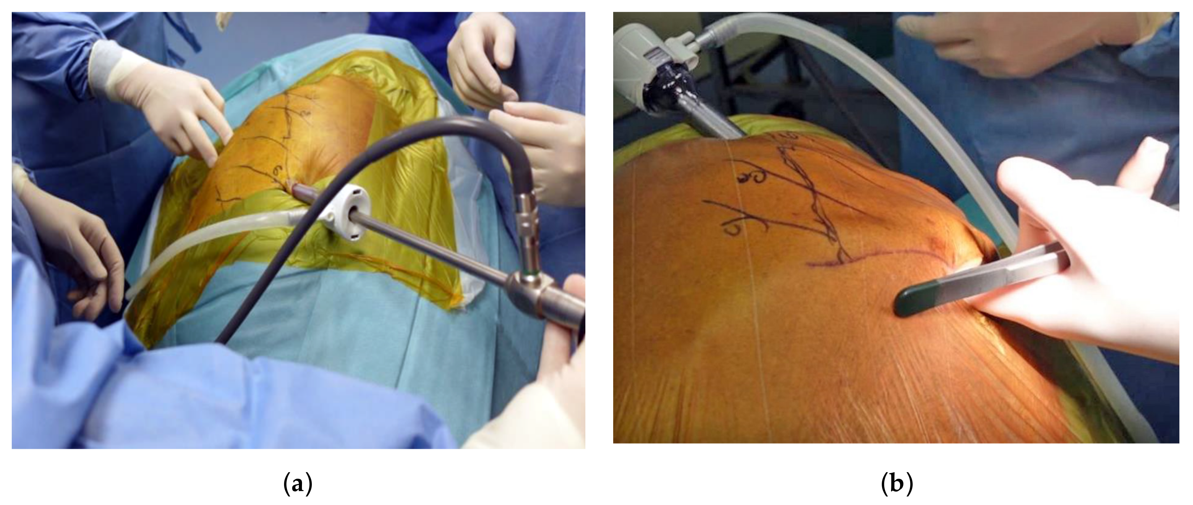 Diagnostics 13 00460 g002