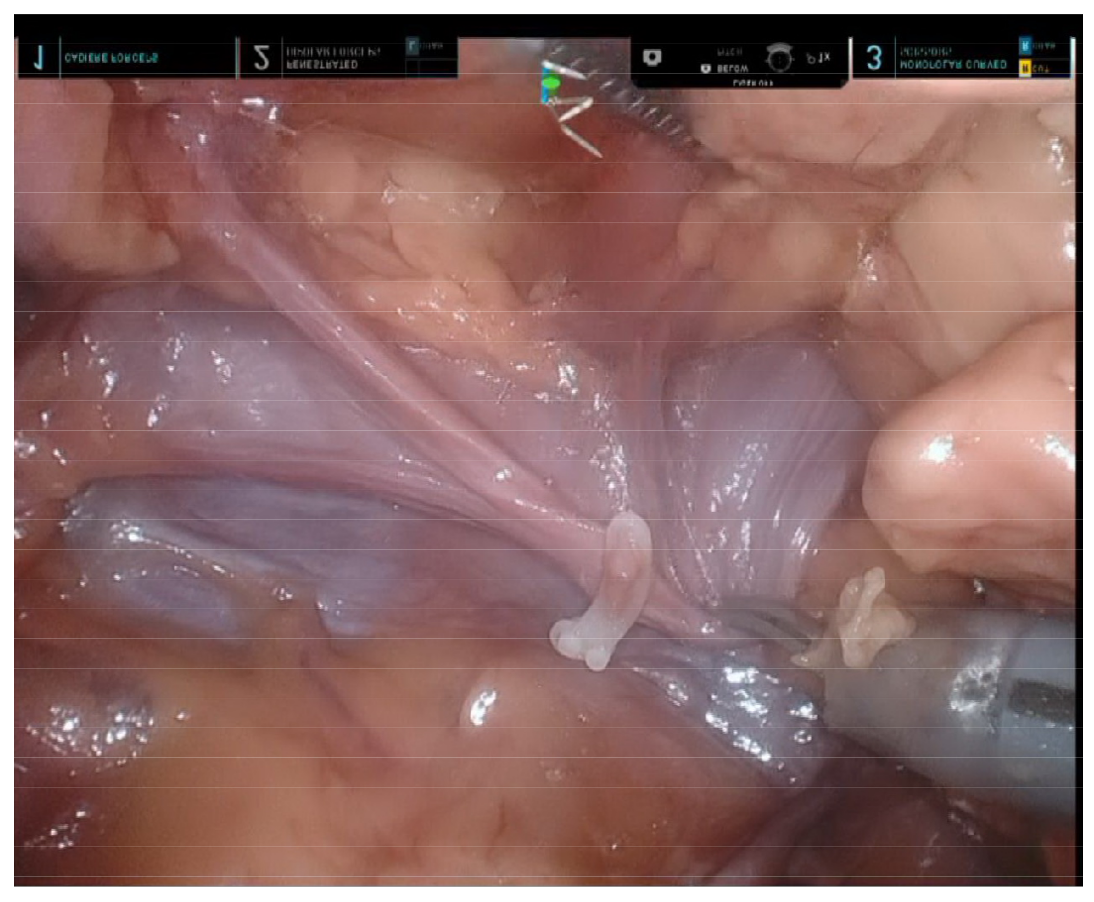 Diagnostics 13 00460 g003