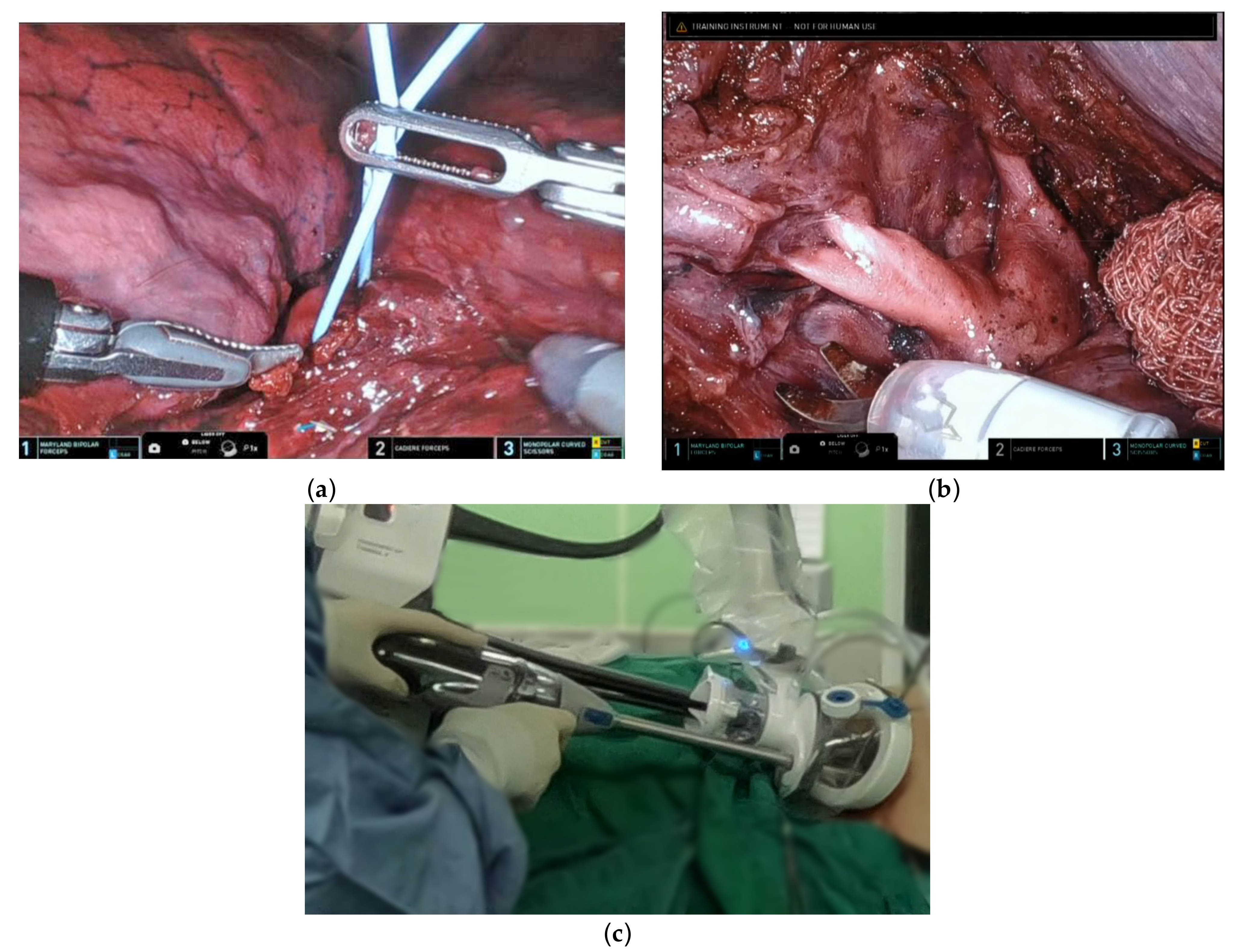 Diagnostics 13 00460 g004
